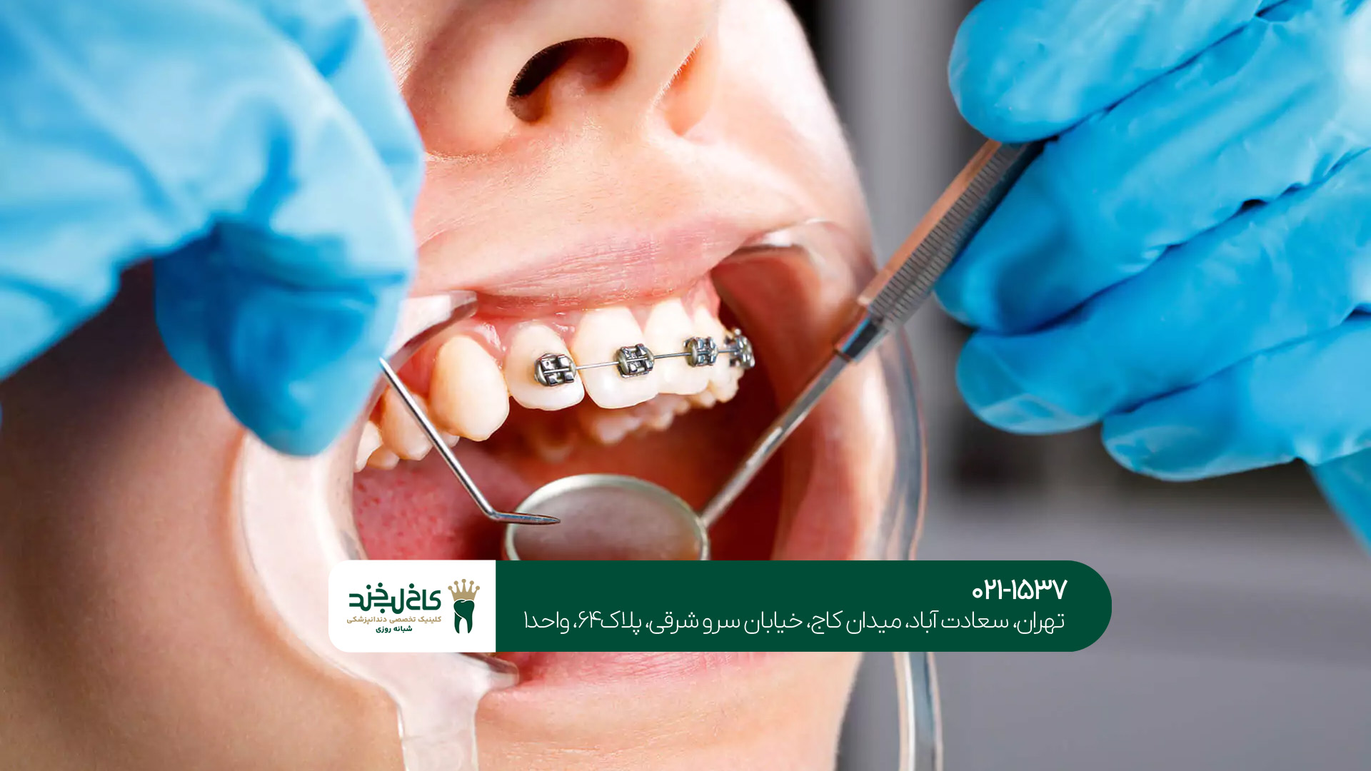 مزایای دندانپزشک متخصص زیبایی مزایای دندانپزشک متخصص زیبایی