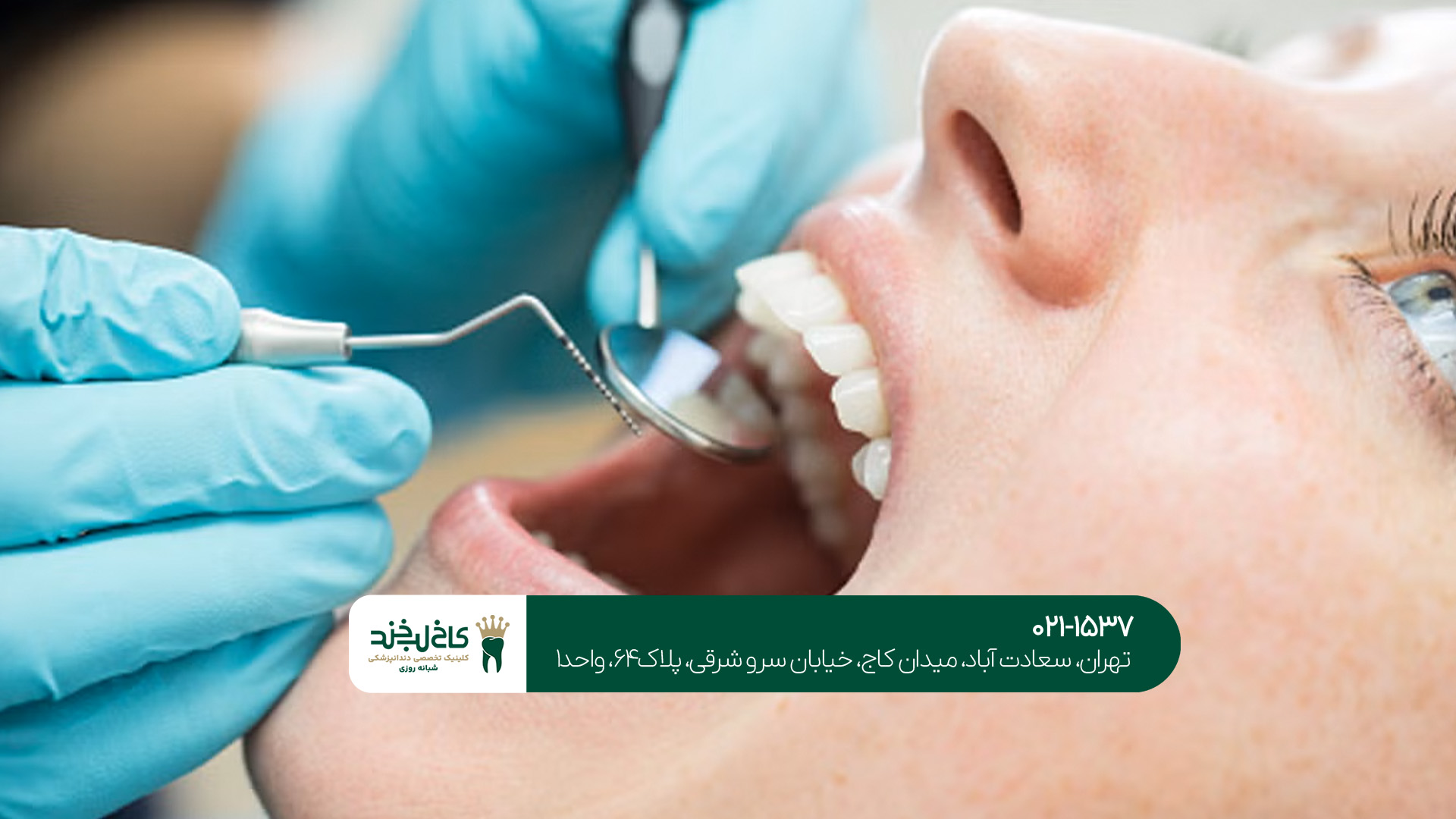 بهترین خدمات دندانپزشکی اقساطی بهترین خدمات دندانپزشکی اقساطی