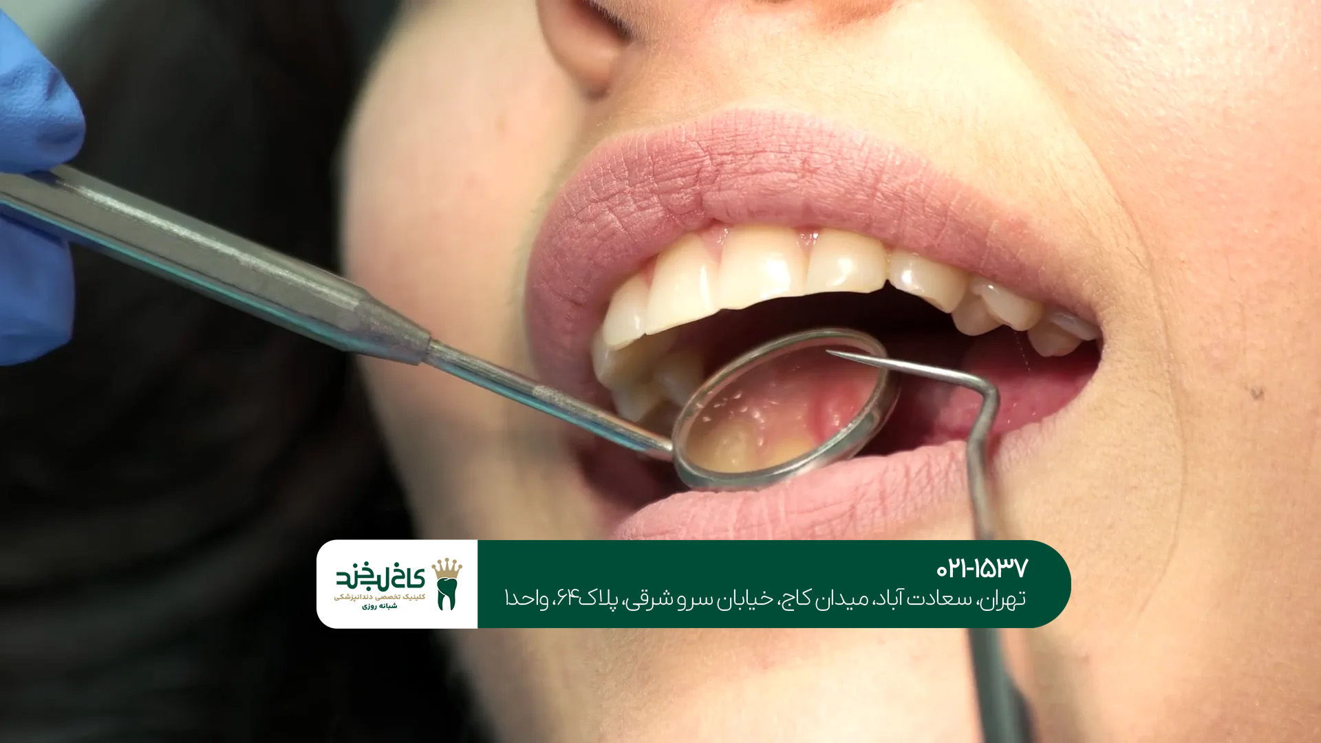 دندانپزشک تخصصی زیبایی دندان دندانپزشک تخصصی زیبایی دندان