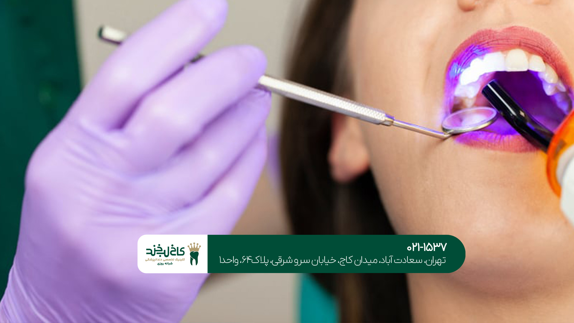 مراحل کامپوزیت دندان در مرکز تخصصی