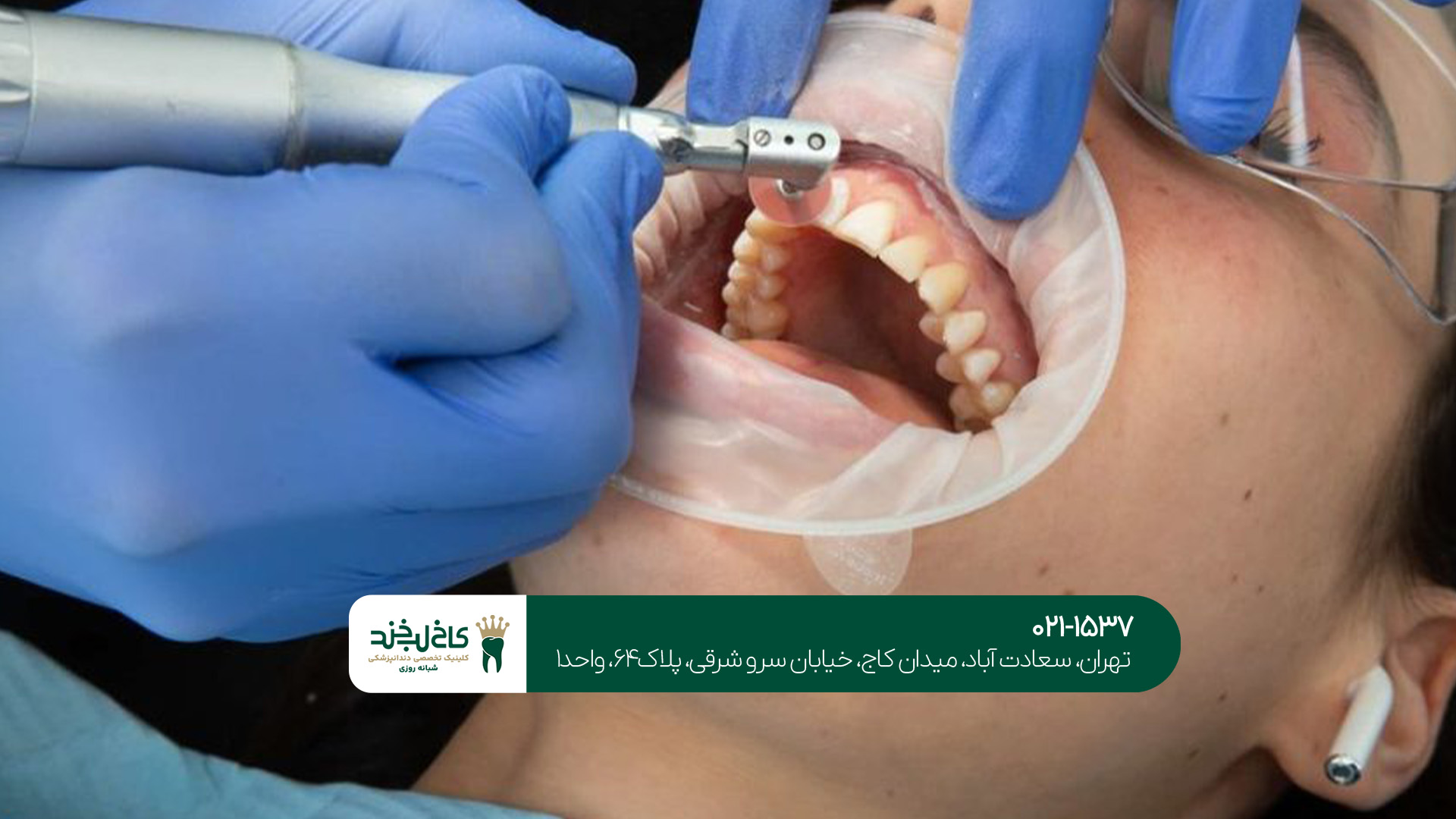 مرکز دندانپزشکی کامپوزیت