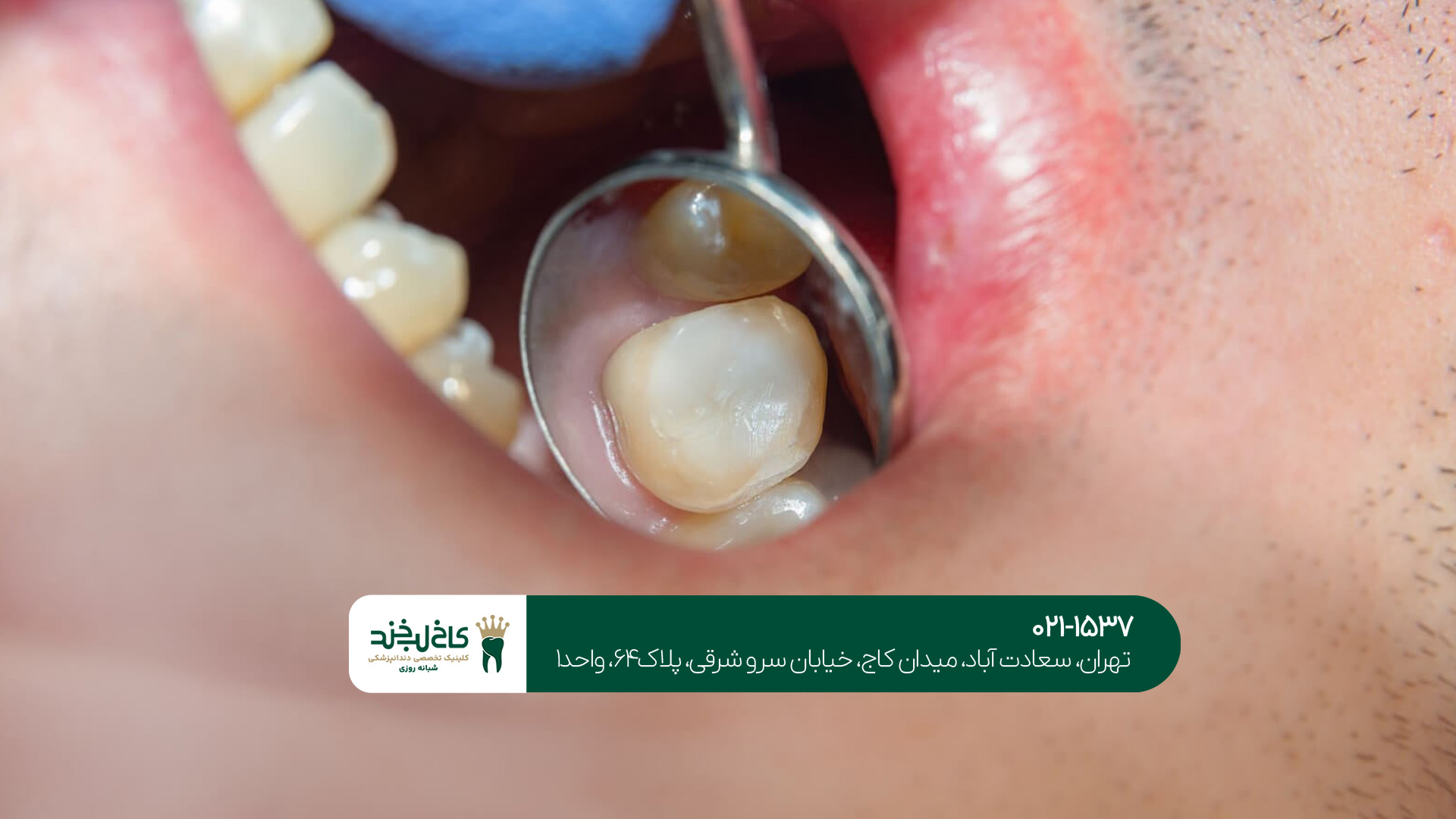  ترمیم دندان در غرب تهران