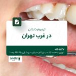 ترمیم دندان در غرب تهران