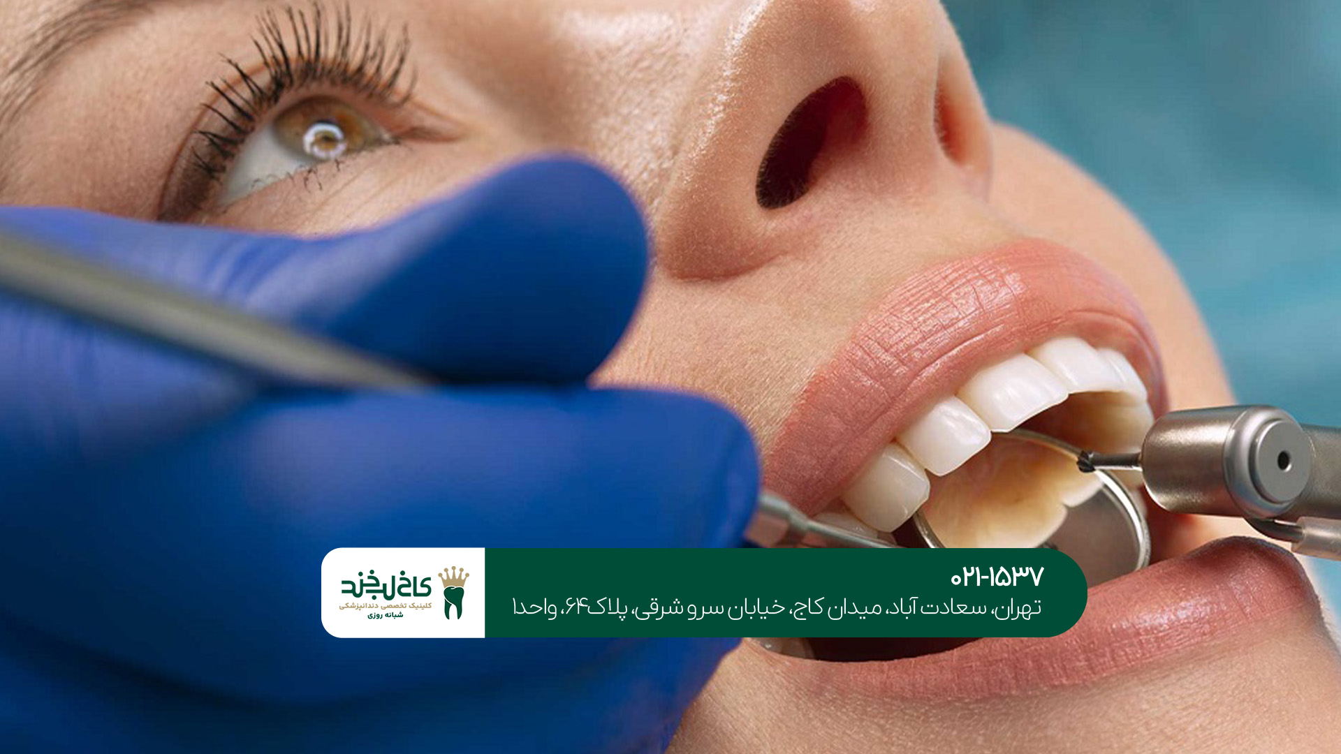  ترمیم دندان در غرب تهران