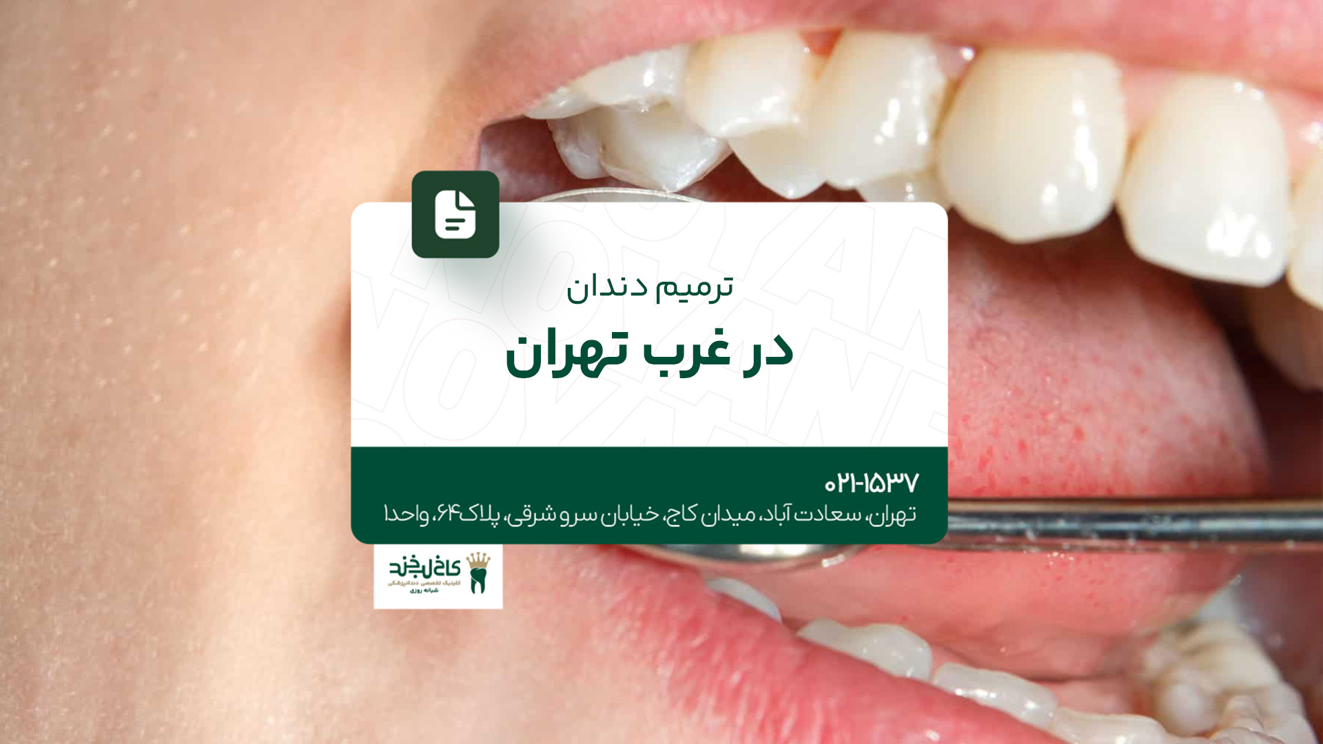  ترمیم دندان در غرب تهران