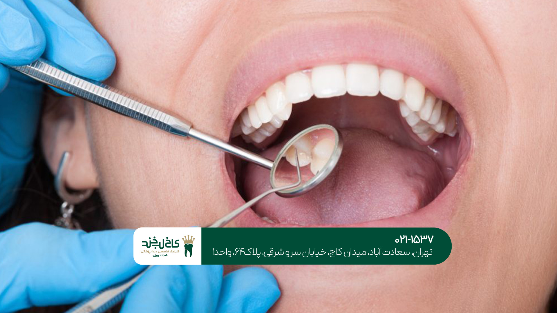 ترمیم و کشیدن دندان در تهران