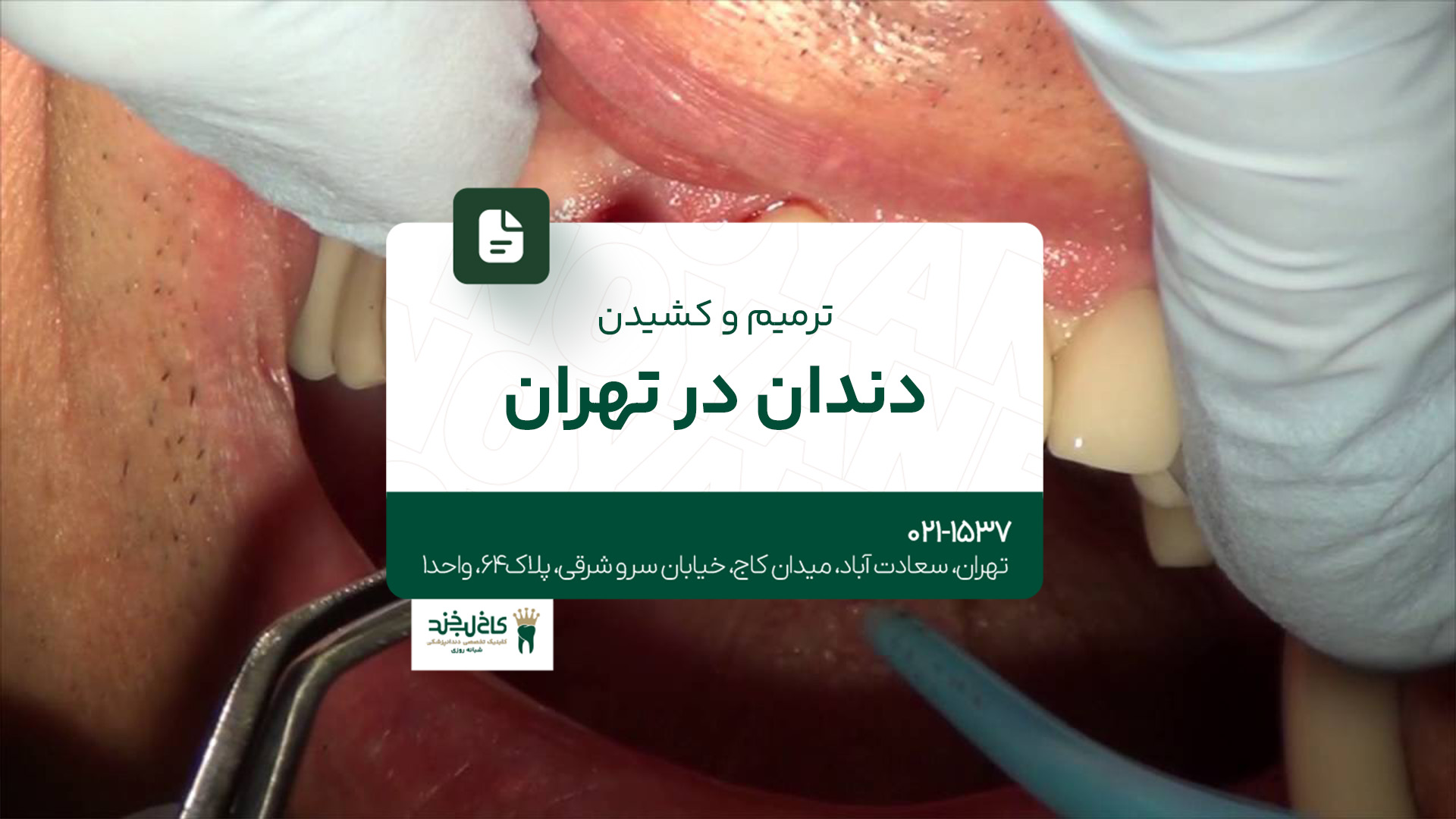 ترمیم و کشیدن دندان در تهران