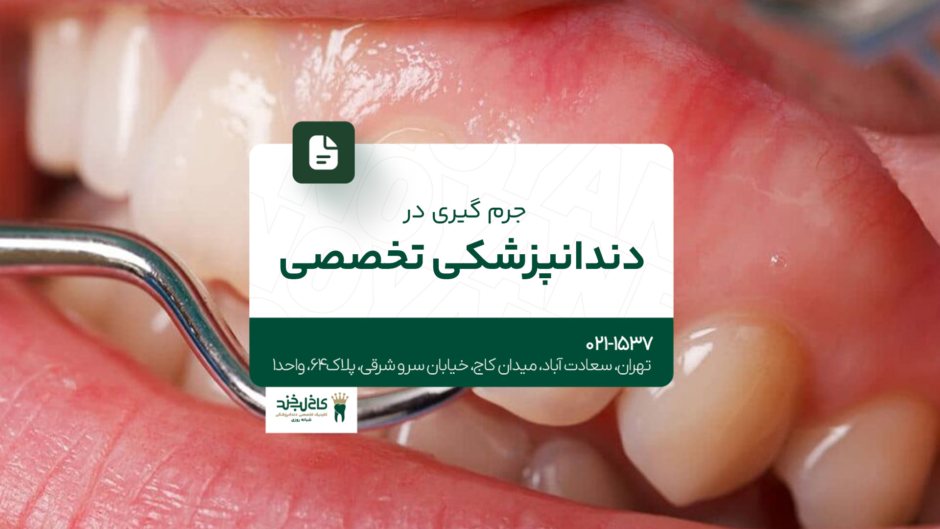 جرم گیری در دندانپزشکی تخصصی