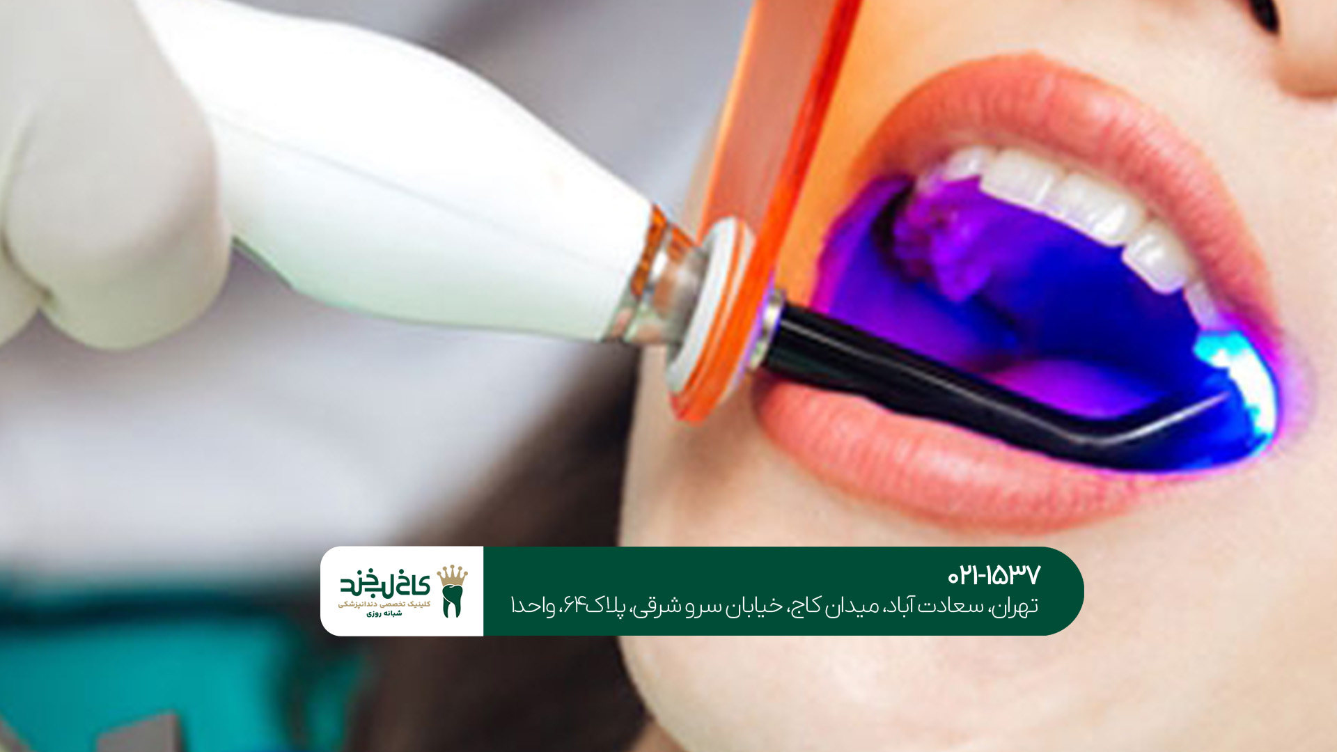 جرم گیری دندان در مرکز تخصصی جرم گیری دندان در مرکز تخصصی