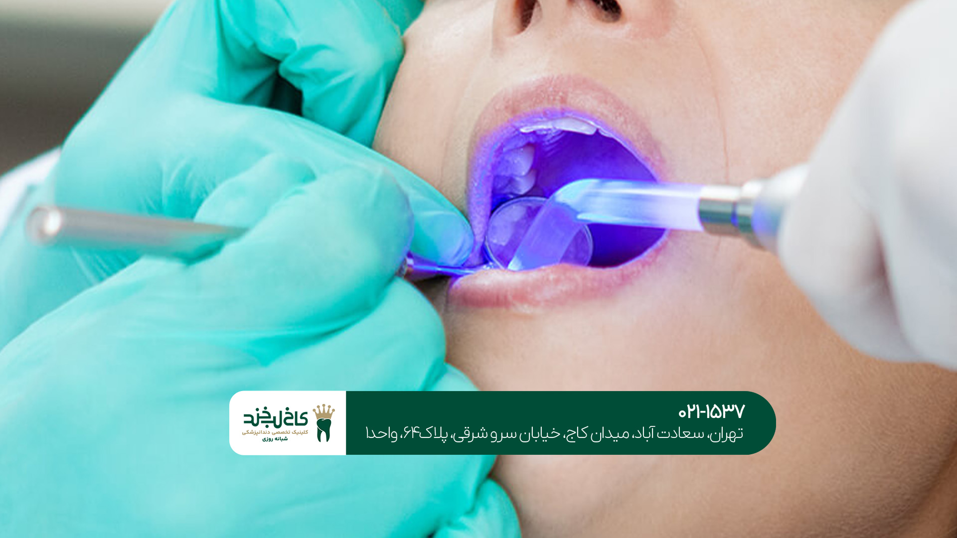 جرم گیری دندان در مرکز تخصصی جرم گیری دندان در مرکز تخصصی