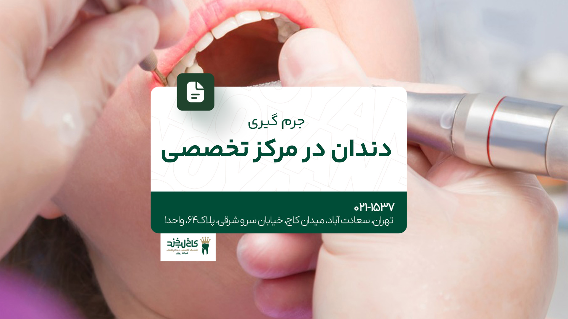 جرم گیری دندان در مرکز تخصصی جرم گیری دندان در مرکز تخصصی