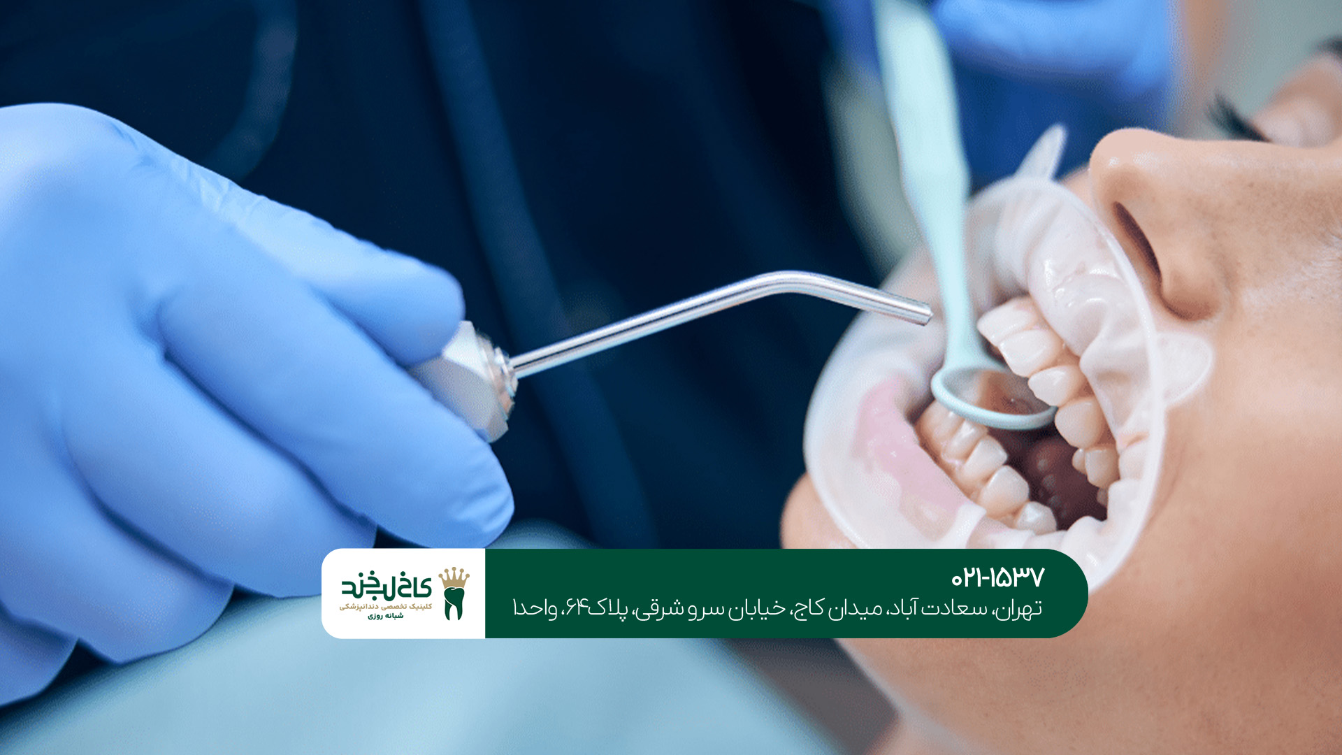 خدمات بهترین دندانپزشکی عمومی خدمات بهترین دندانپزشکی عمومی