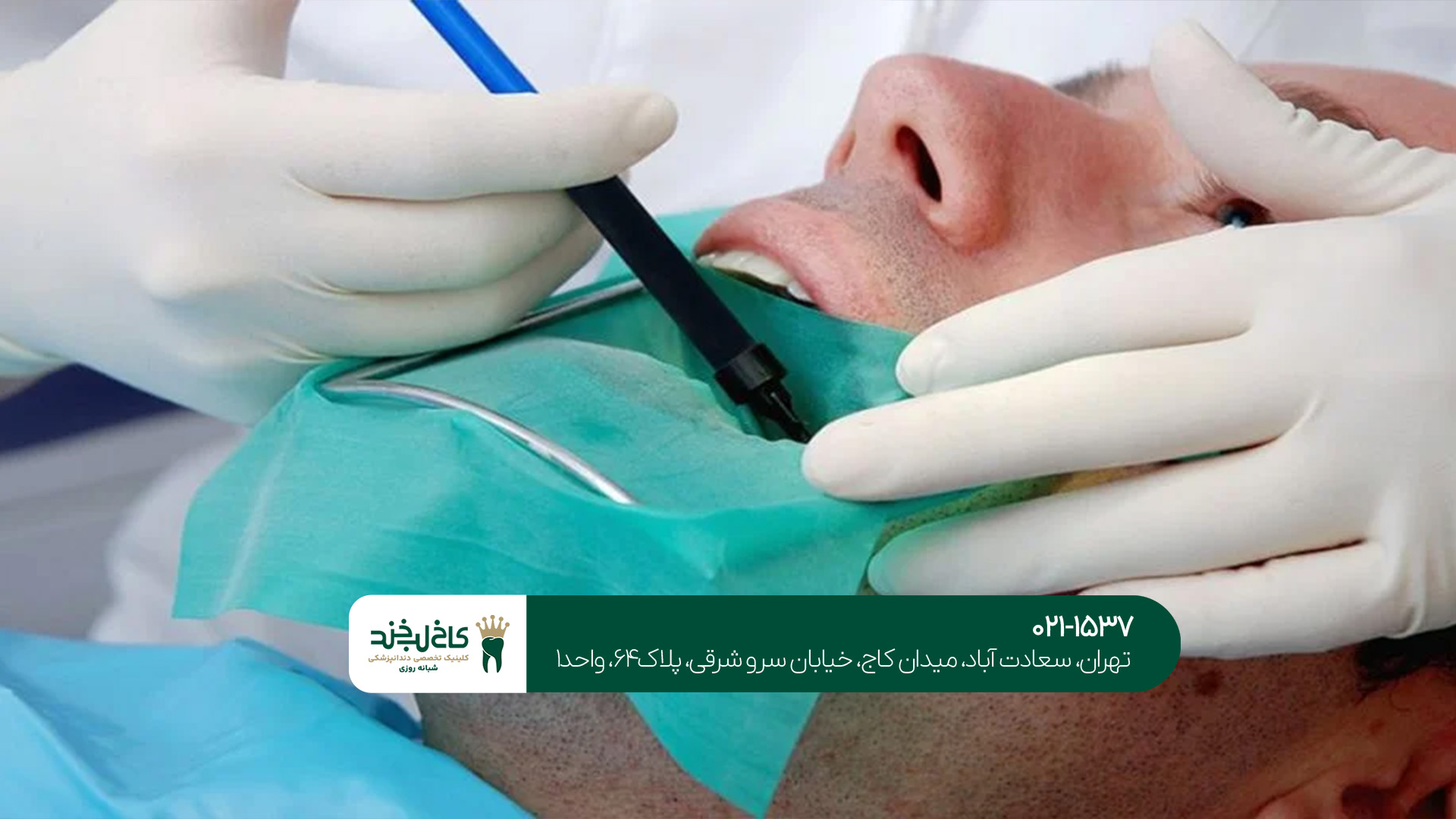 درمان ریشه دندان در شمال تهران درمان ریشه دندان در شمال تهران