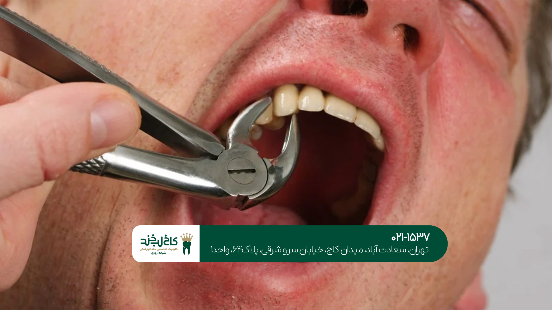 دندانپزشک خوب در تهران دندانپزشک خوب در تهران