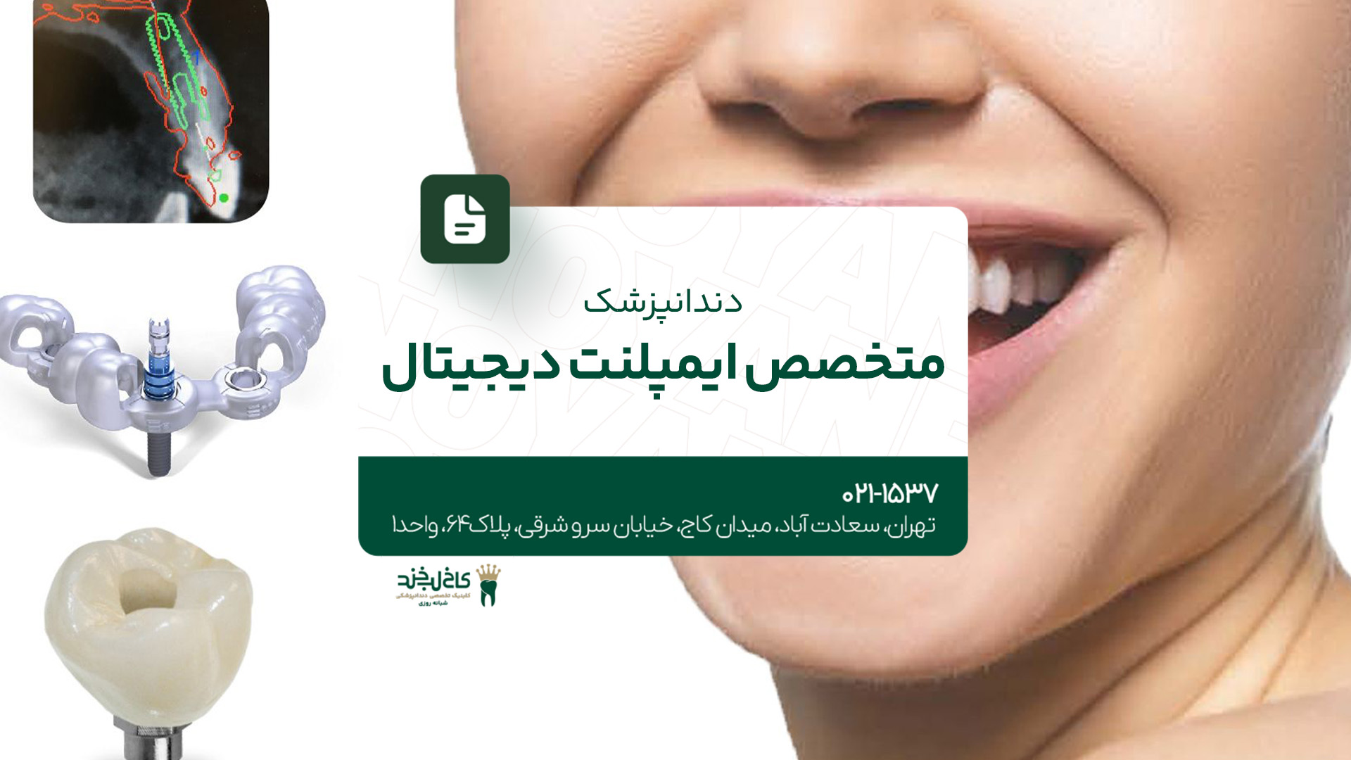 دندانپزشک متخصص ایمپلنت دیجیتال