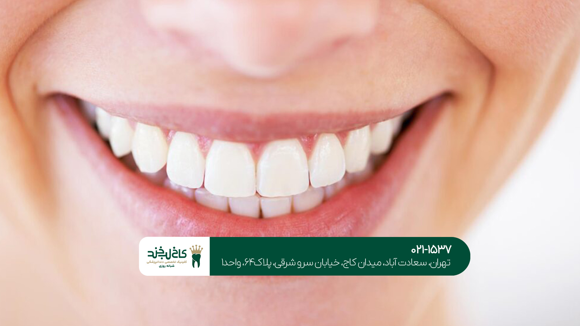 دندانپزشک متخصص زیبایی دندانپزشک متخصص زیبایی