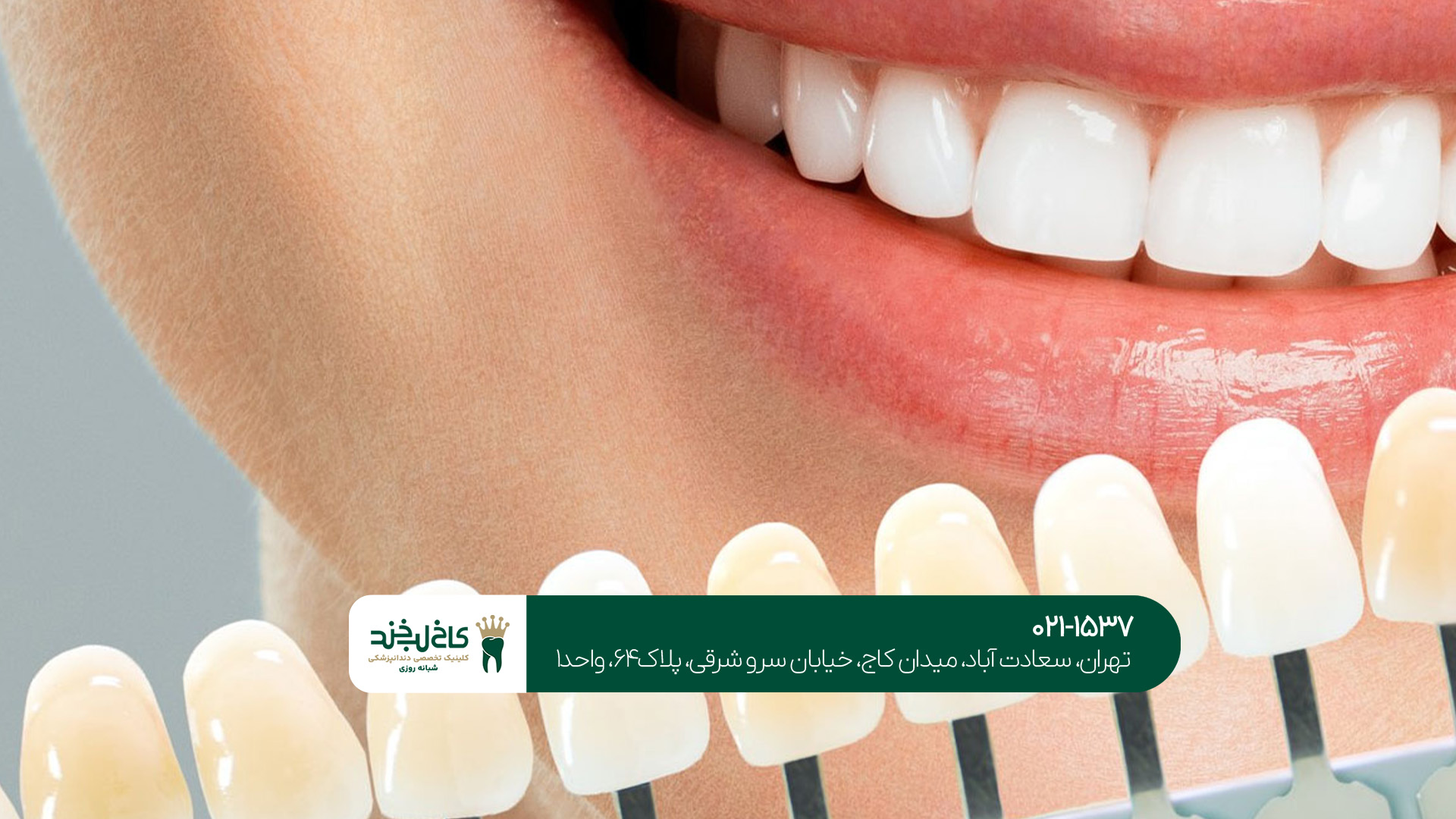 مزایای دندانپزشک تخصصی زیبایی