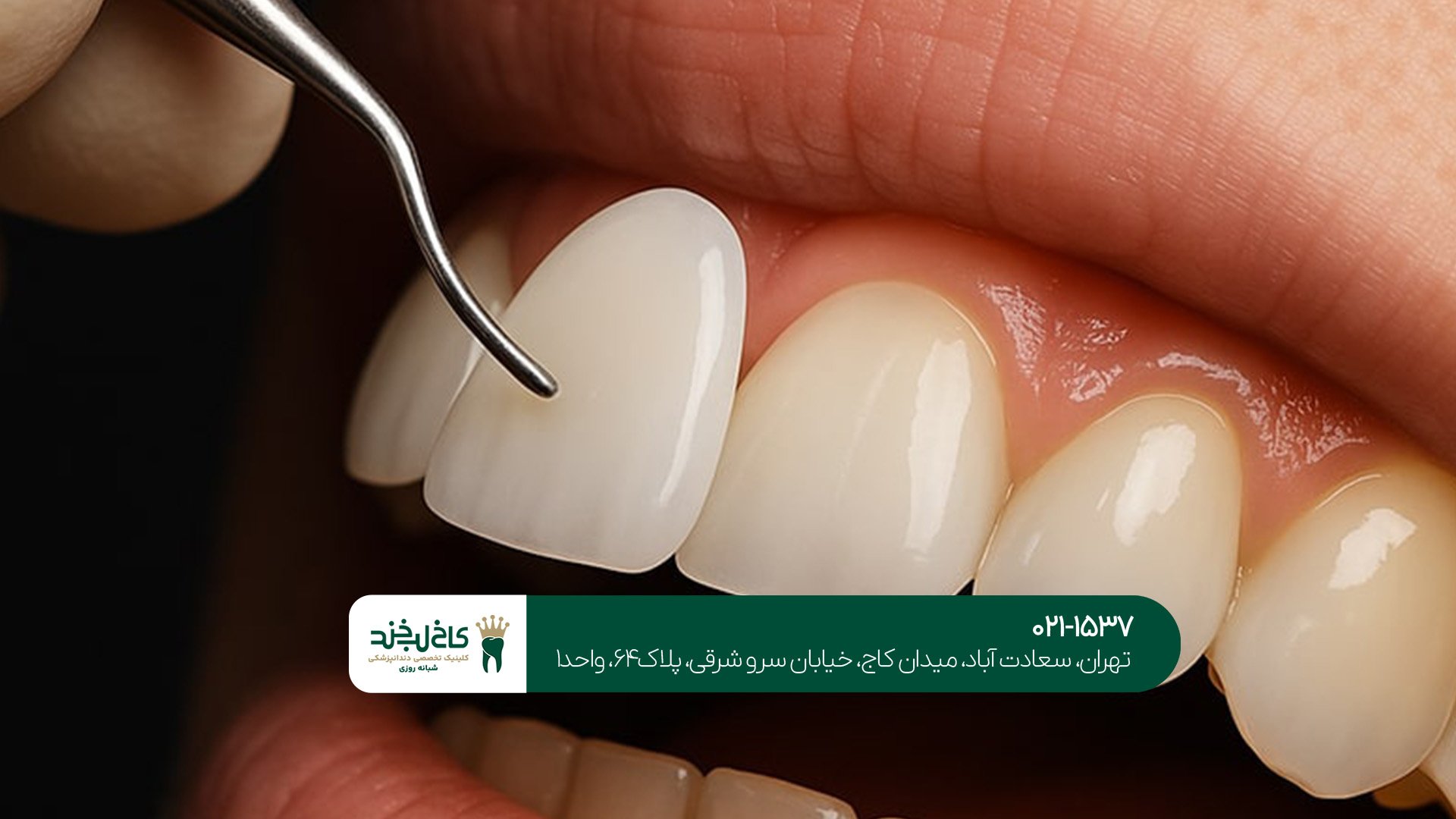 دکتر دندانپزشک زیبایی دکتر دندانپزشک زیبایی