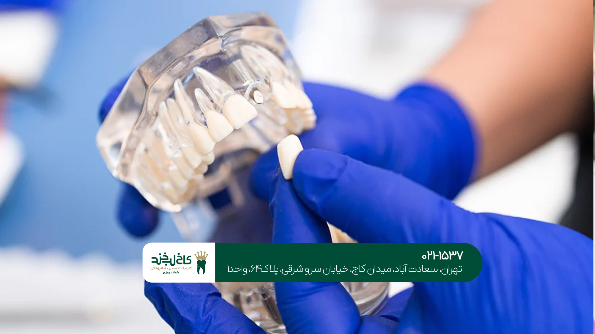 دندانپزشک متخصص ایمپلنت دیجیتال