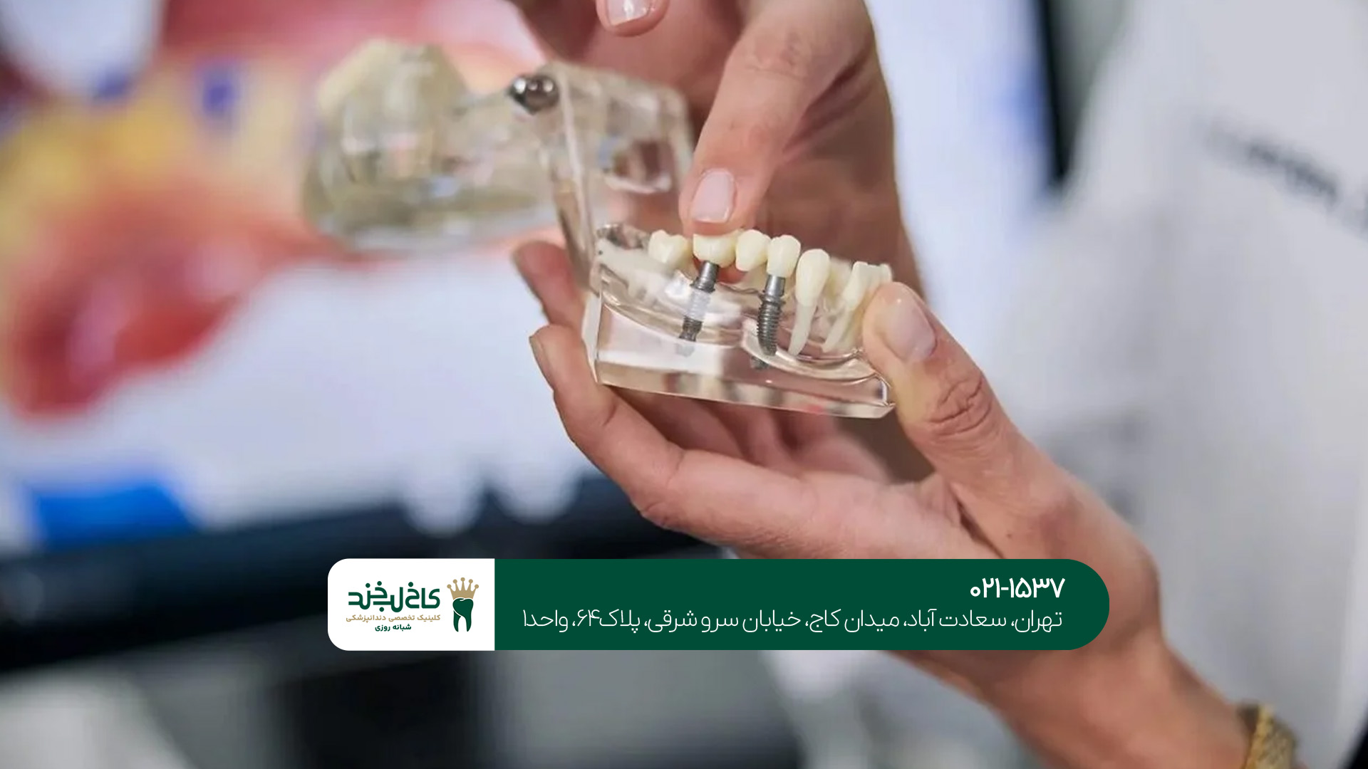 دندانپزشک متخصص ایمپلنت دیجیتال