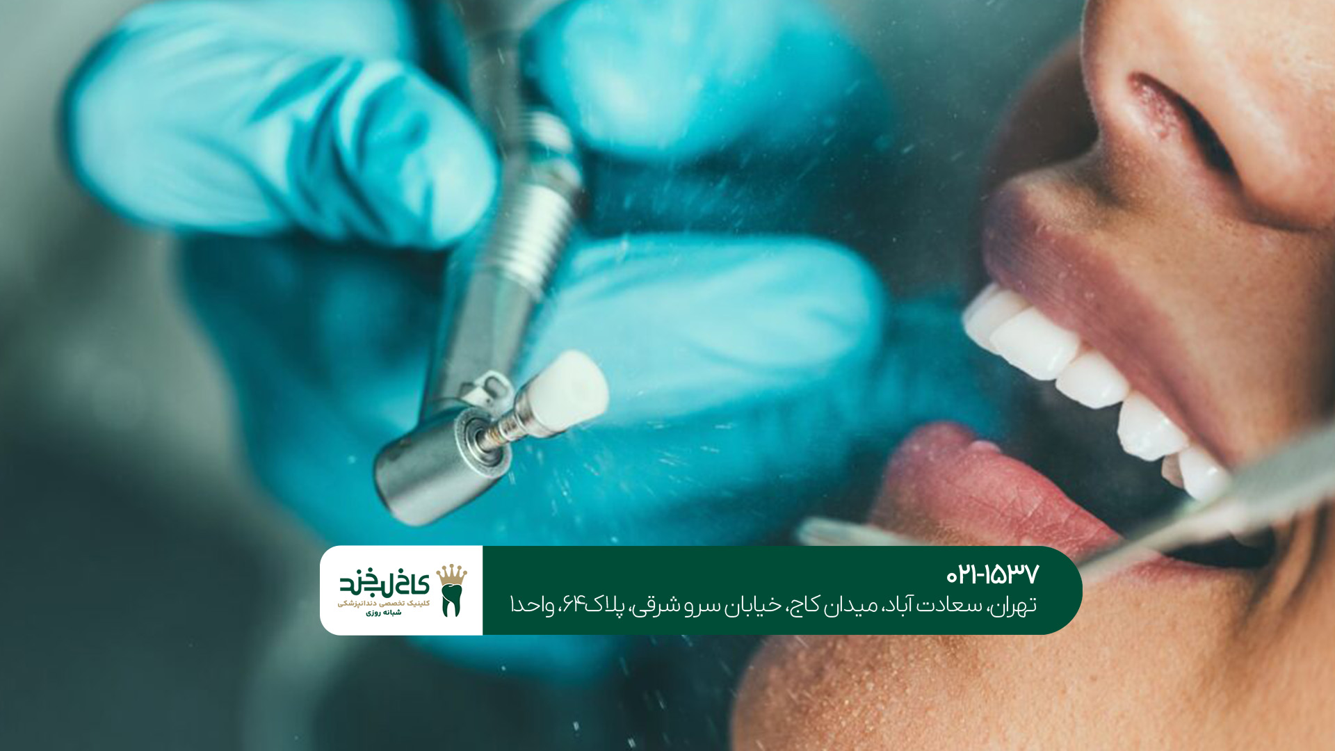 دندانپزشکی برتر در غرب تهران