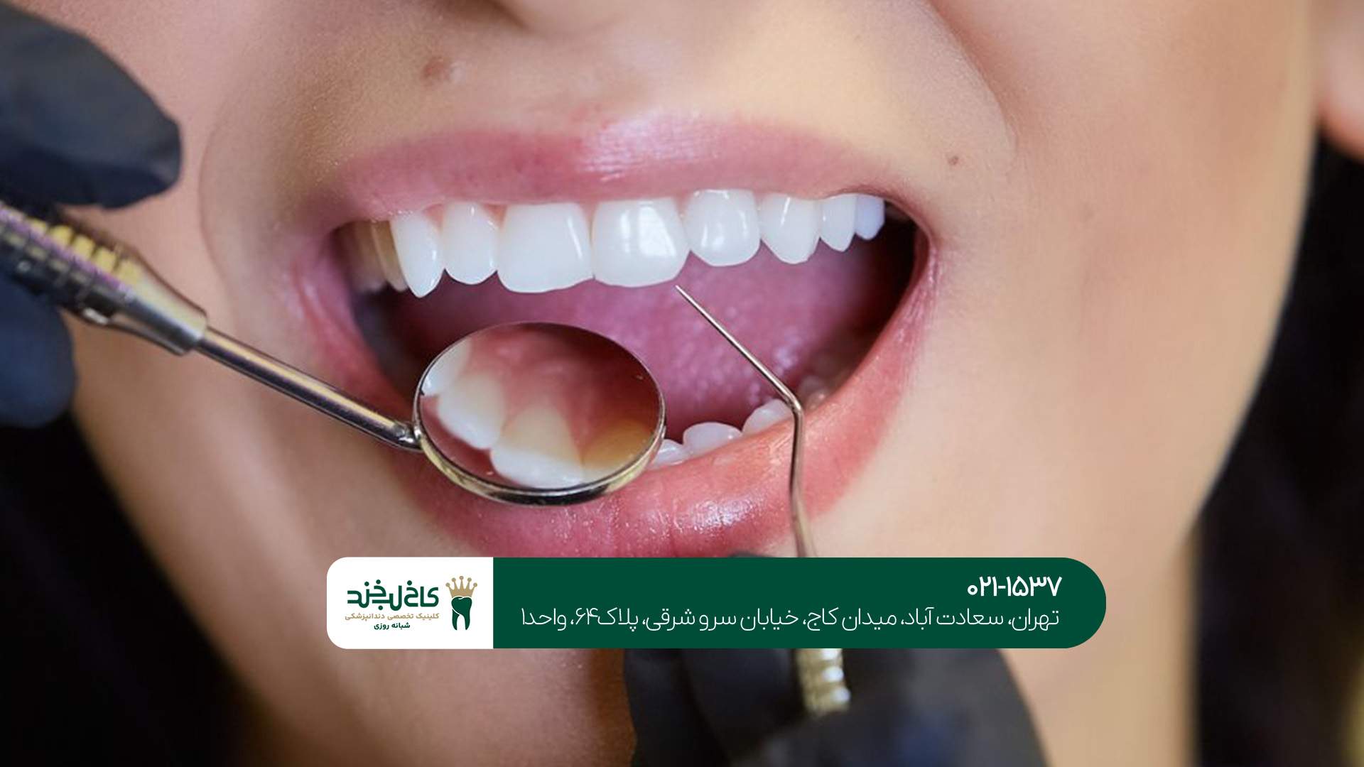 دندانپزشکی جردن دندانپزشکی جردن