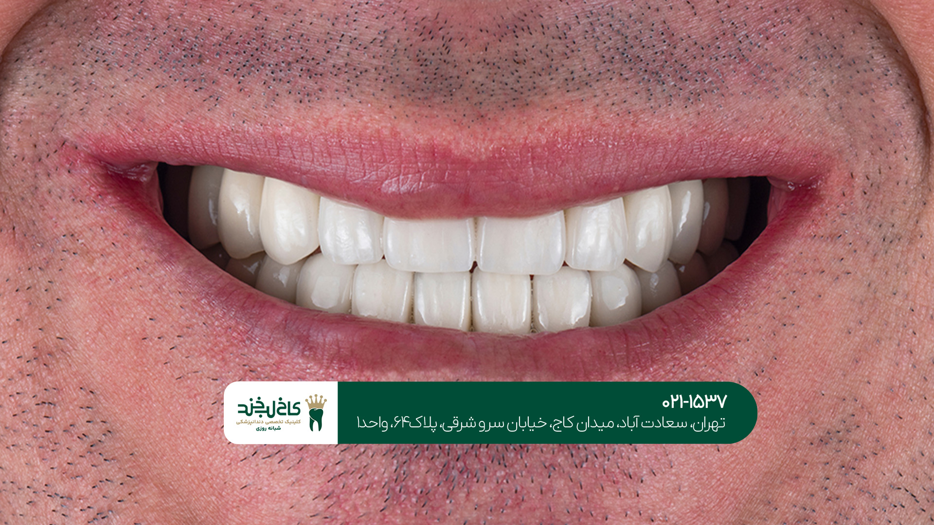 دندانپزشکی زیبایی و ترمیم دندانپزشکی زیبایی و ترمیم