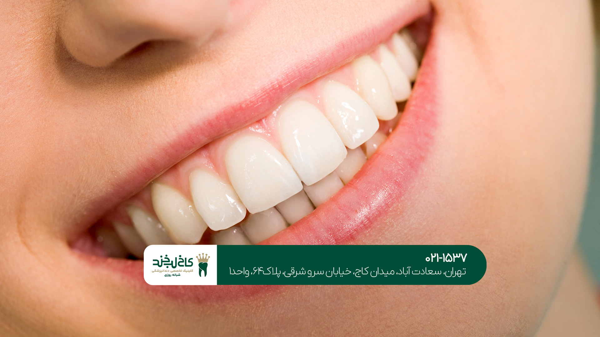 دندانپزشکی زیبایی و ترمیم دندانپزشکی زیبایی و ترمیم