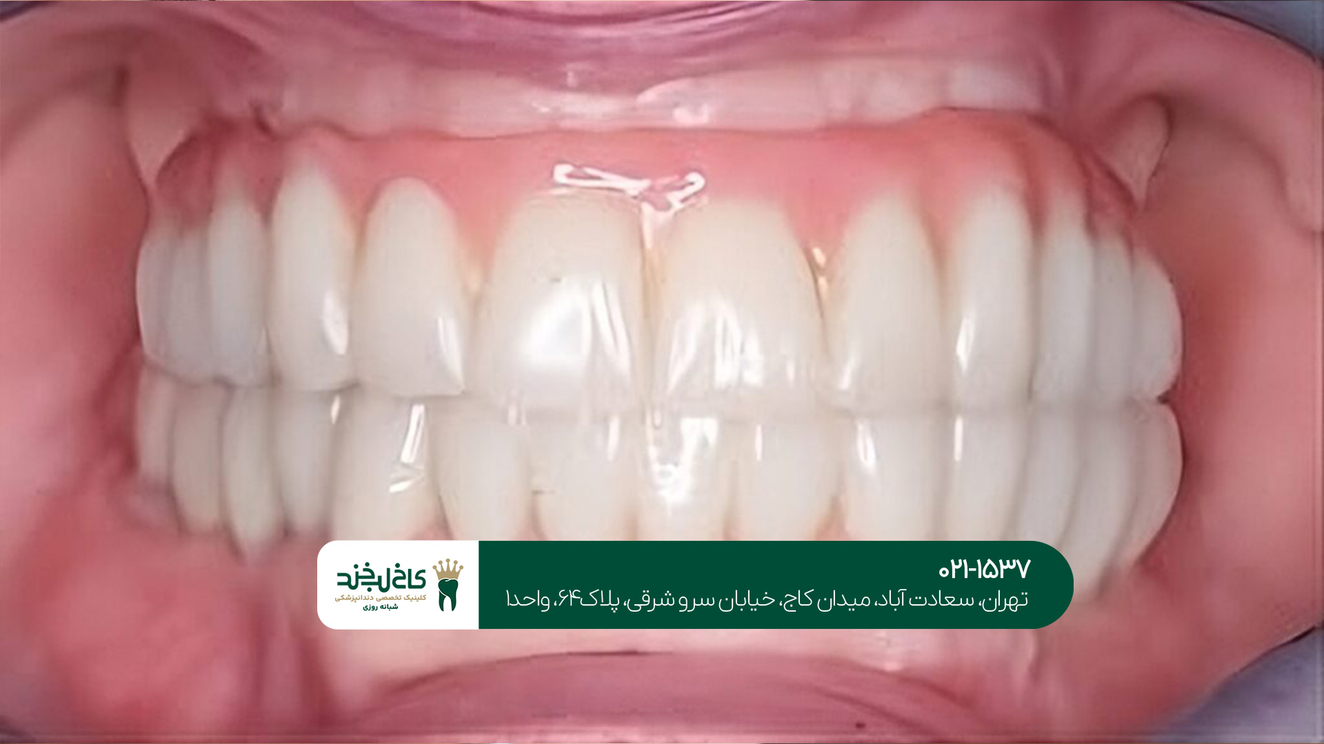 دندانپزشکی زیبایی و ترمیم دندانپزشکی زیبایی و ترمیم