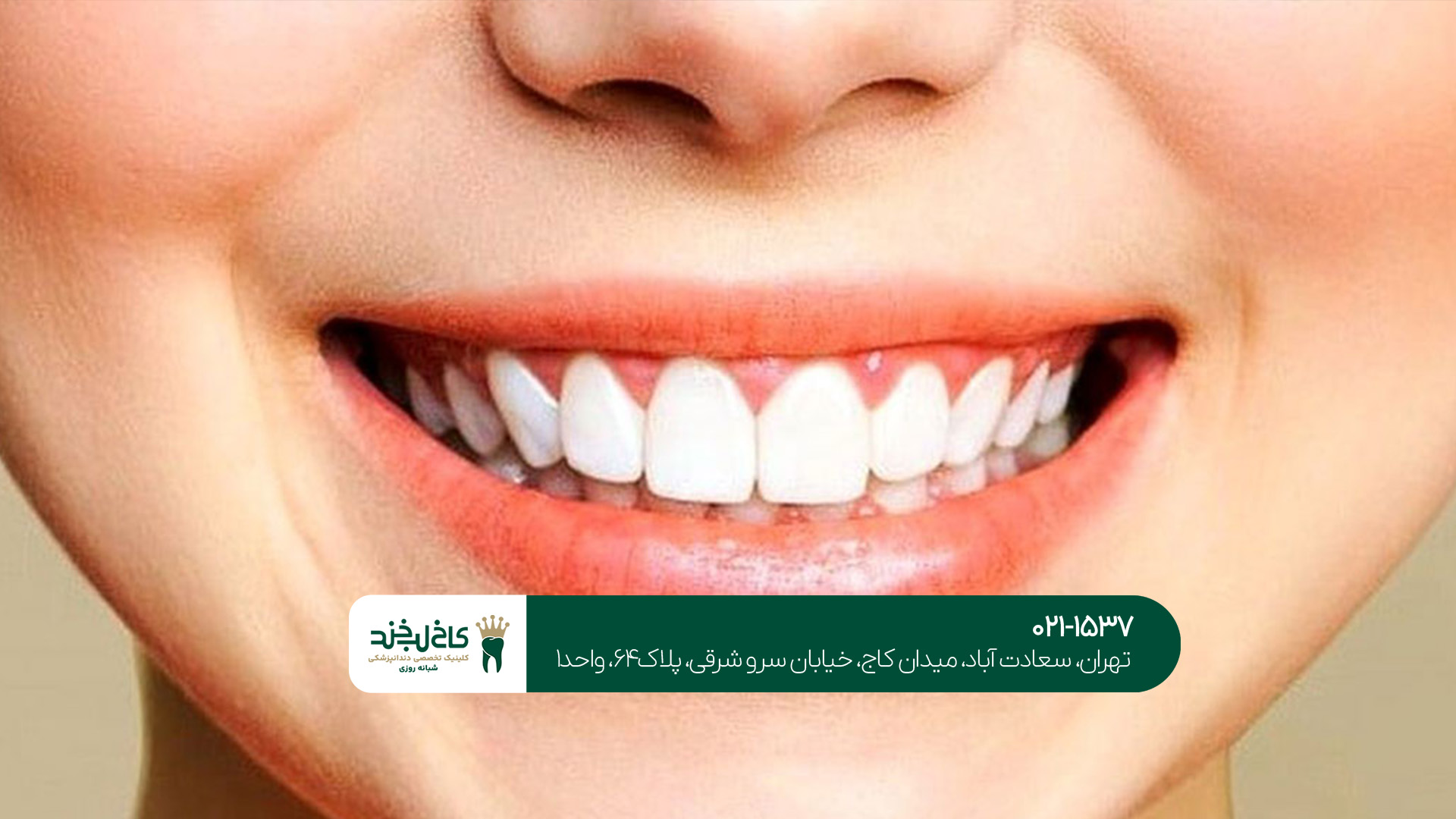 دندانپزشکی زیبایی و خدمات آن دندانپزشکی زیبایی و خدمات آن