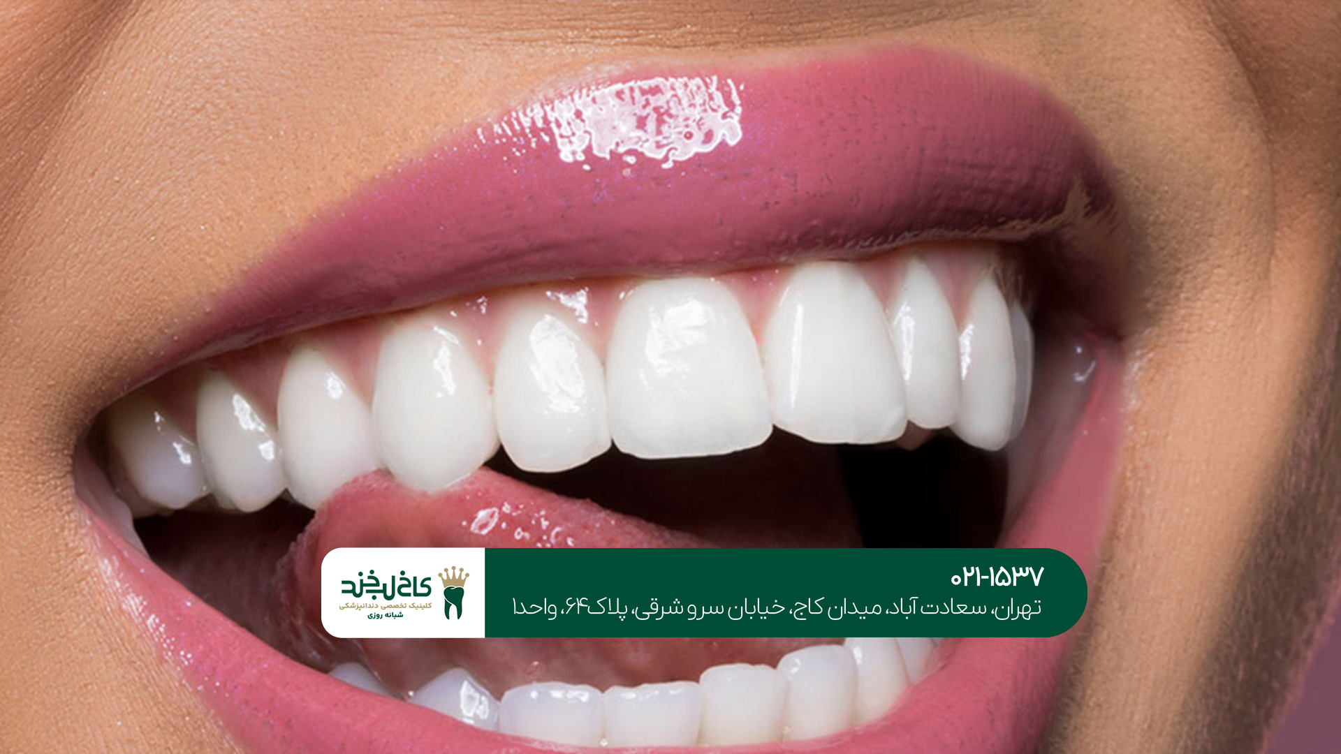 دندانپزشکی زیبایی و خدمات آن دندانپزشکی زیبایی و خدمات آن