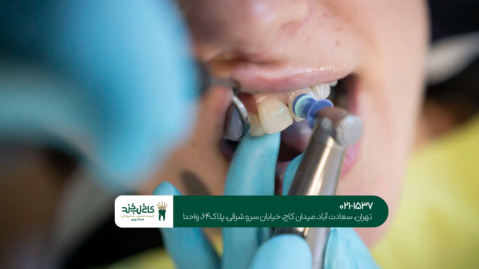 ایمپلنت دیجیتال در کلینیک تخصصی ایمپلنت دیجیتال در کلینیک تخصصی