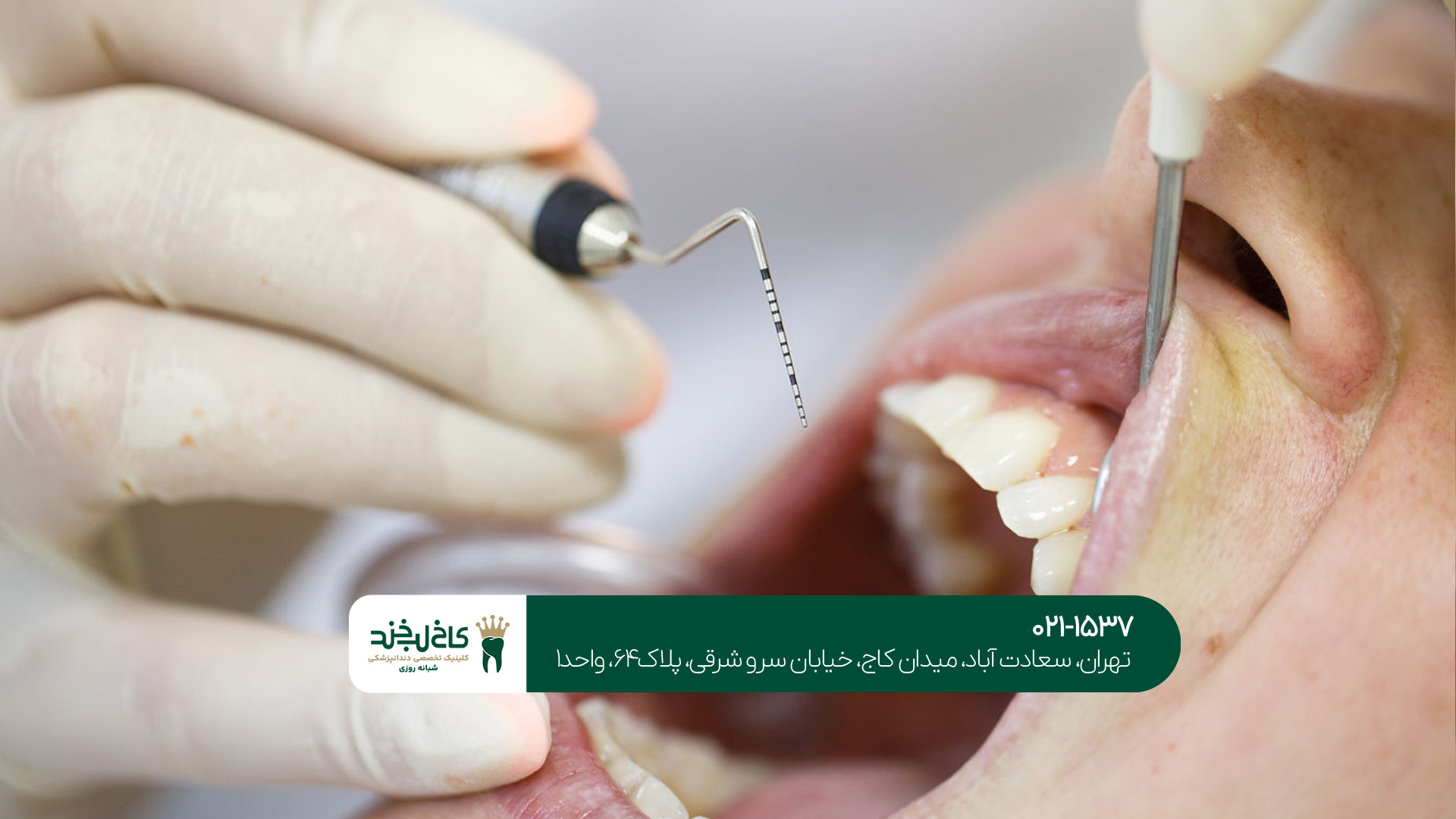 مرکز درمانی تخصصی ایمپلنت دندان مرکز درمانی تخصصی ایمپلنت دندان