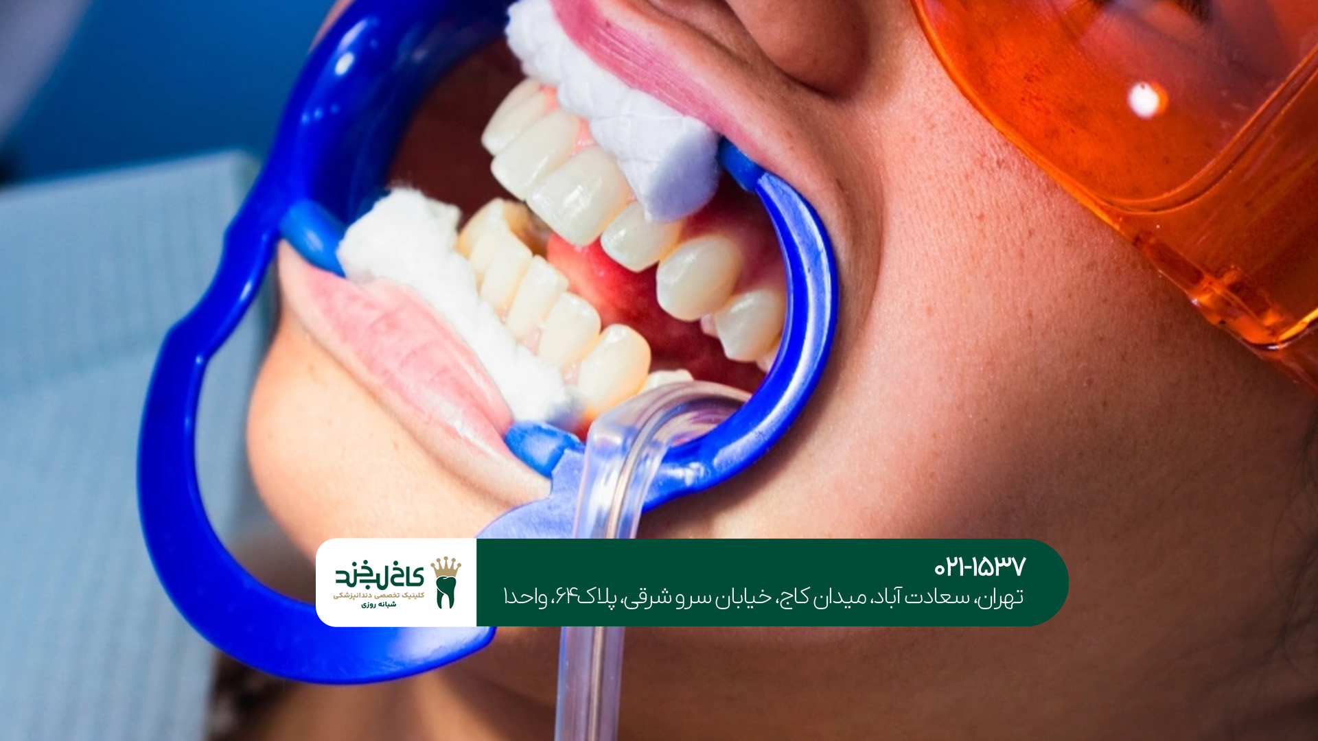 دندانپزشکی پیشرفته در تهران دندانپزشکی پیشرفته در تهران