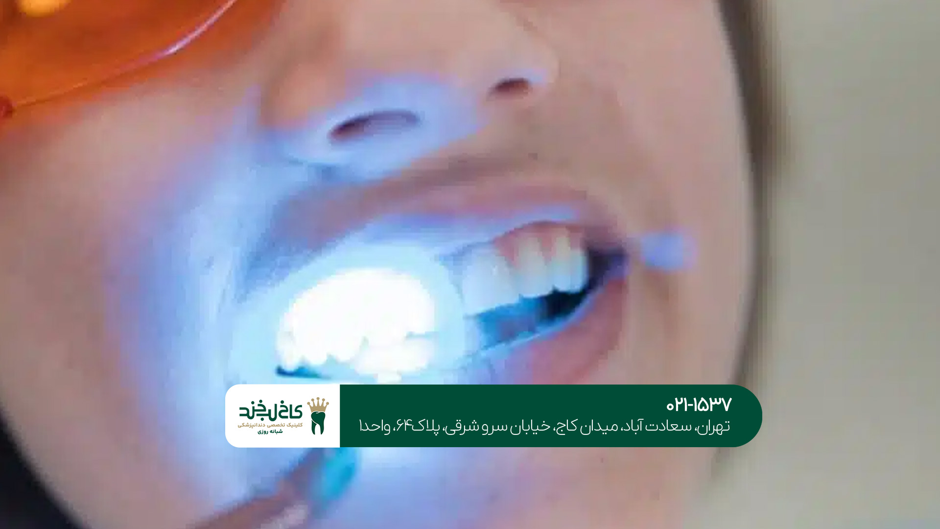 دندانپزشکی پیشرفته دندانپزشکی پیشرفته