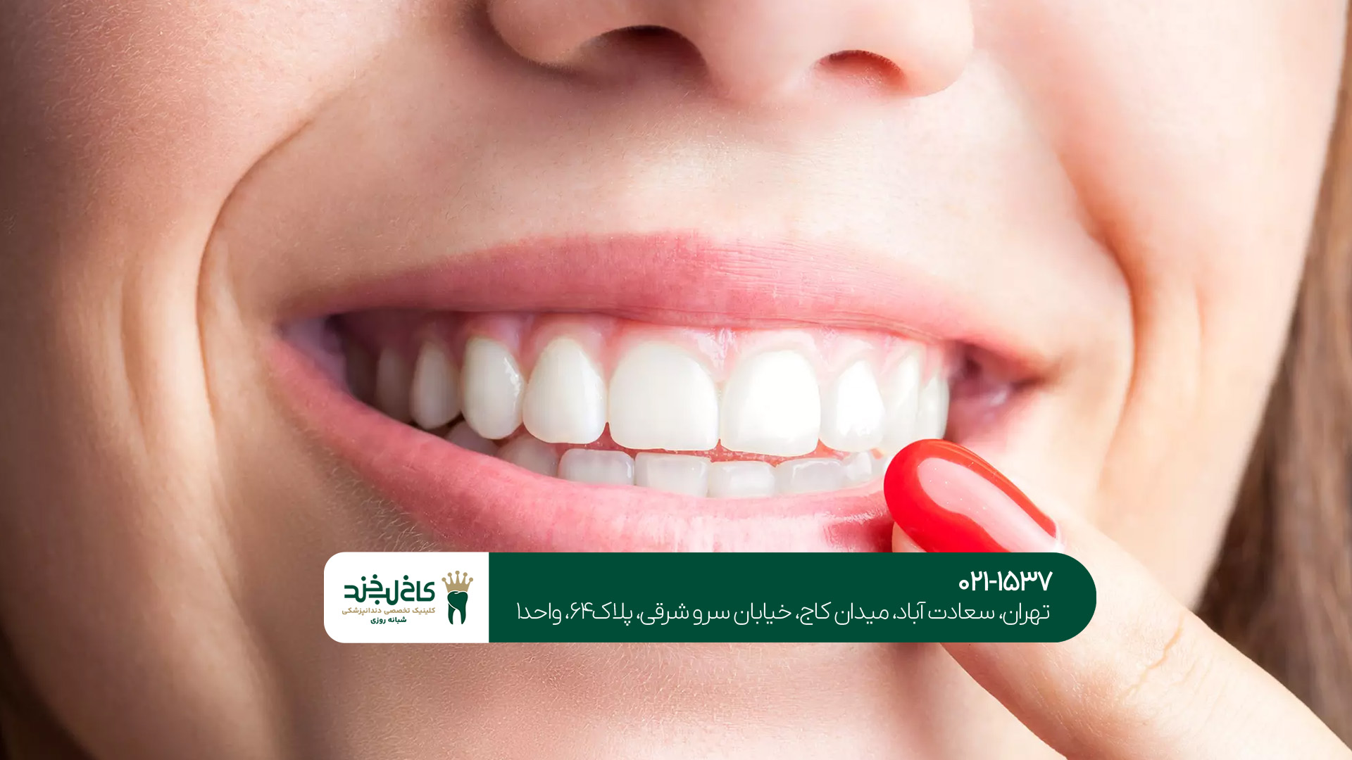 دندانپزشکی پیشرفته در تهران دندانپزشکی پیشرفته در تهران