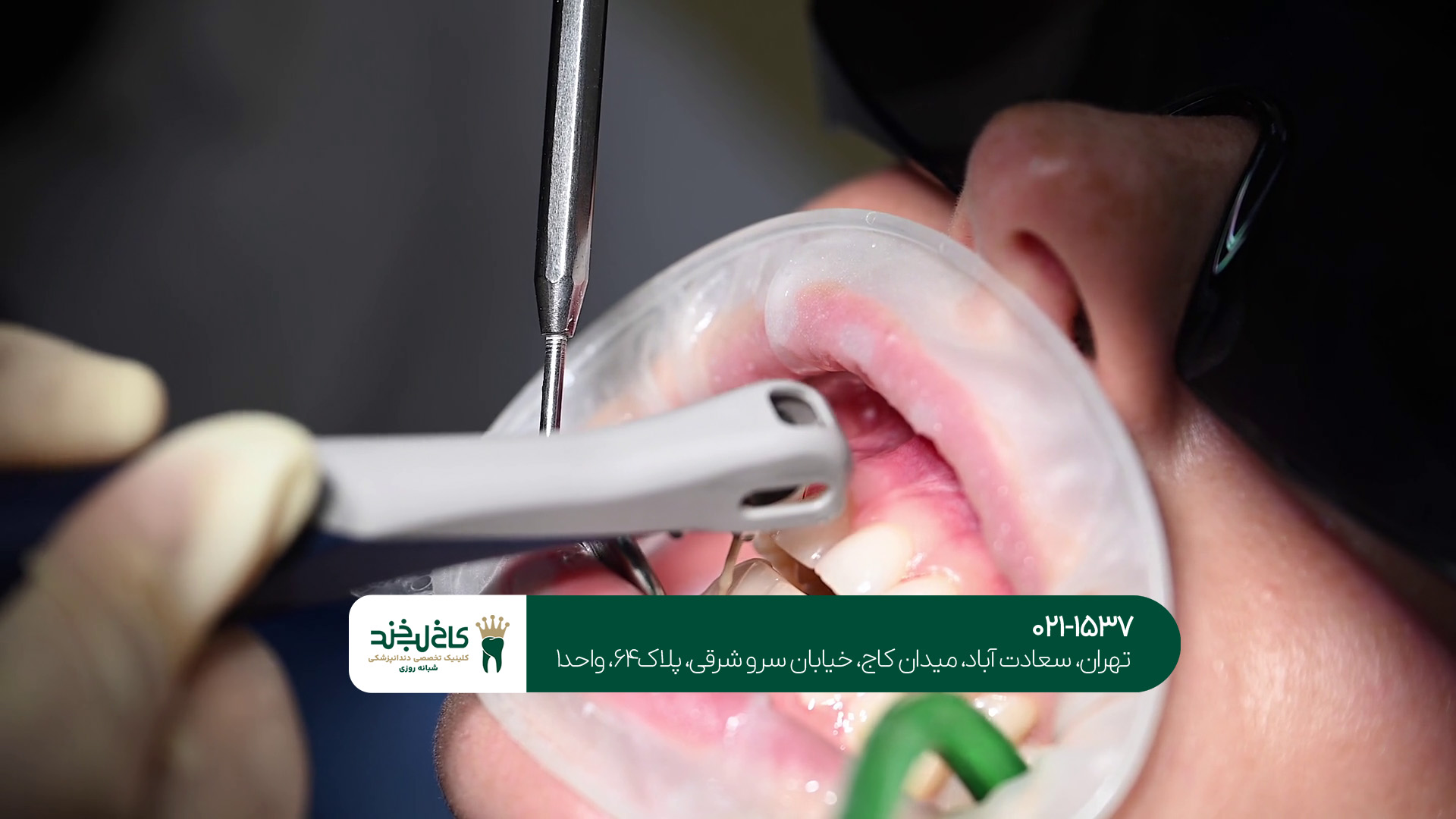 دندانپزشکی زیبایی و درمانی تهران دندانپزشکی زیبایی و درمانی تهران