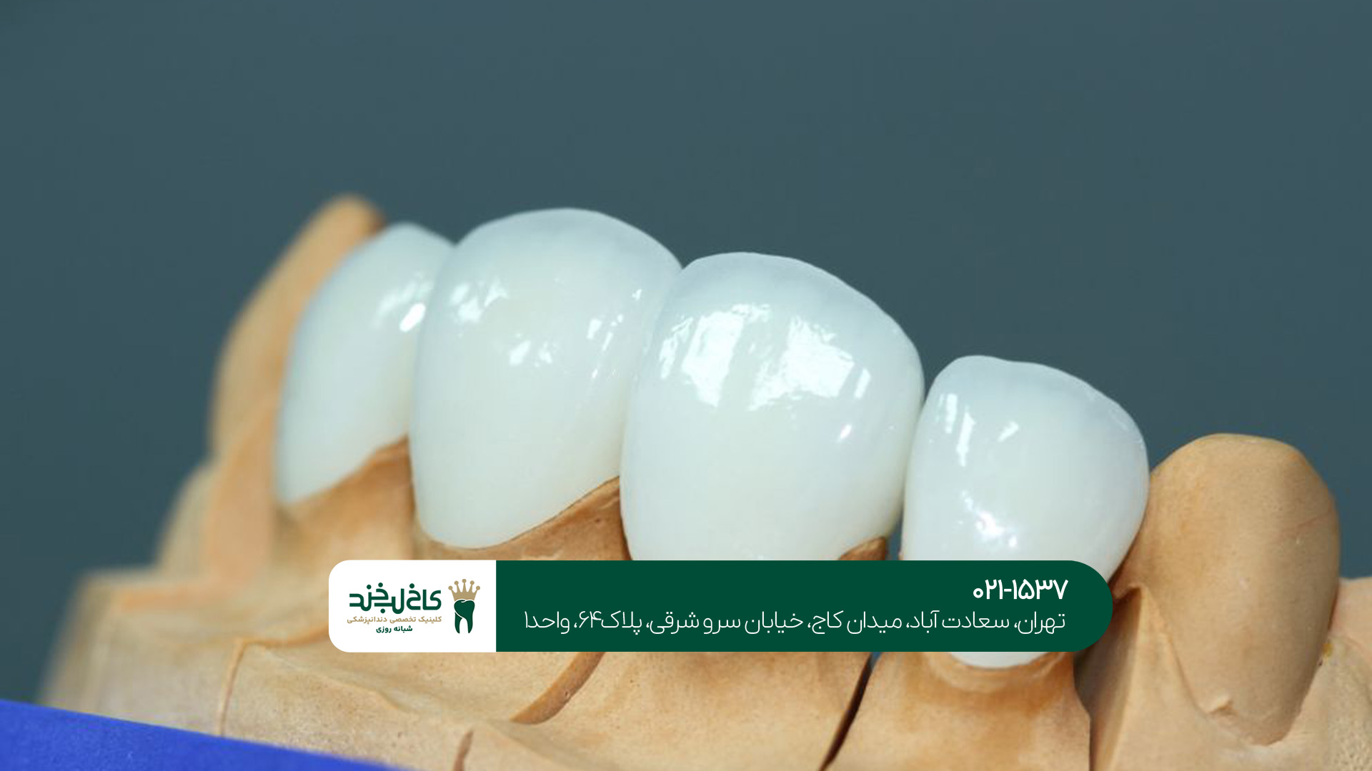 دندانپزشکی زیبایی و درمانی تهران دندانپزشکی زیبایی و درمانی تهران