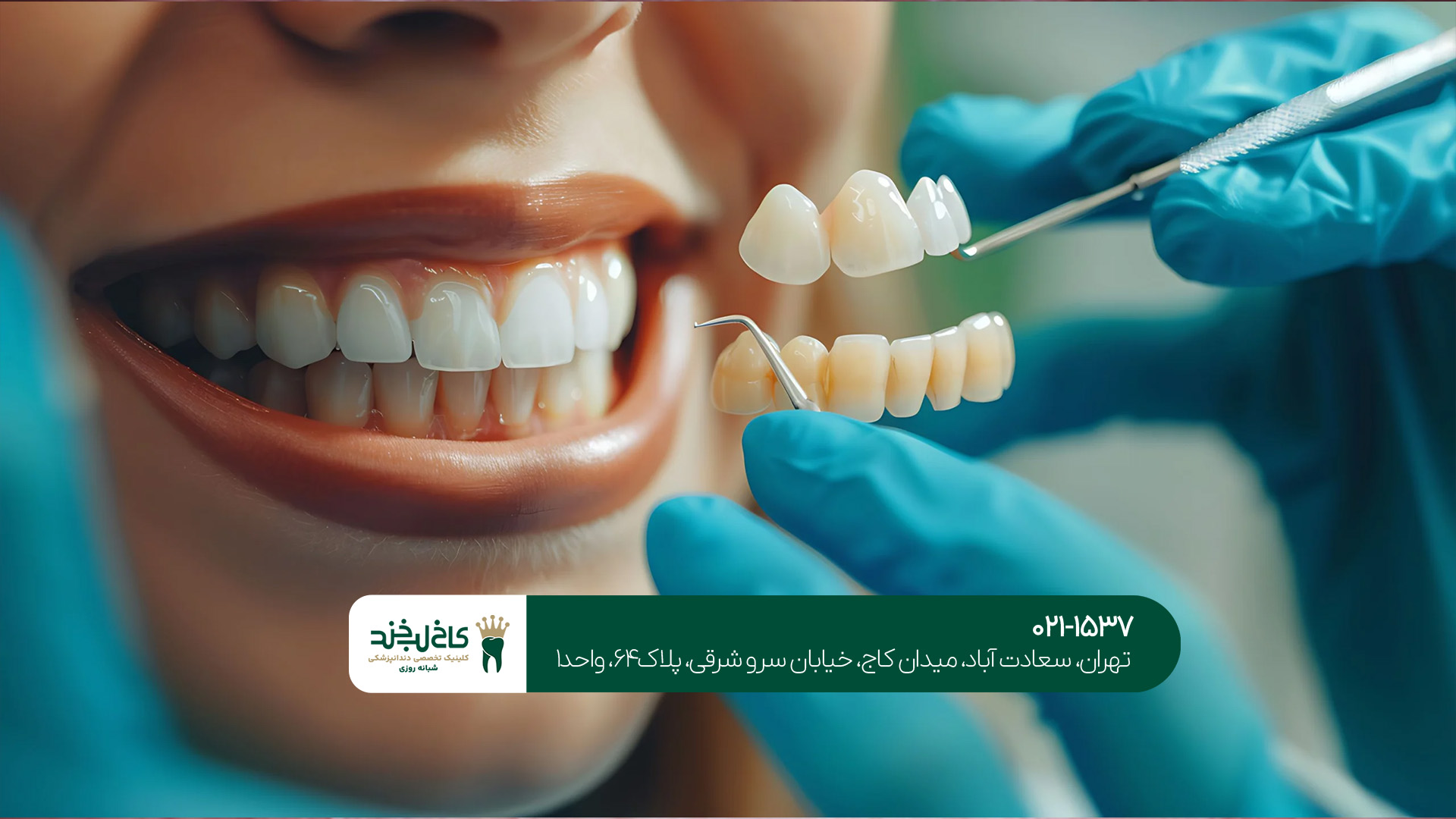 دندانپزشکی زیبایی و درمانی تهران دندانپزشکی زیبایی و درمانی تهران