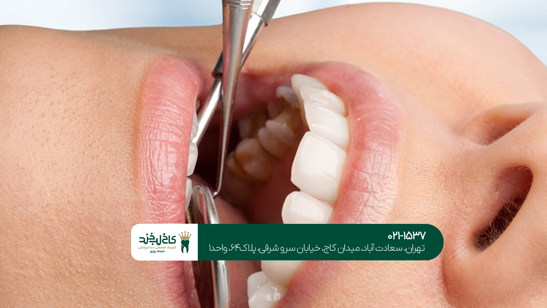 دکتر دندانپزشک تهران دکتر دندانپزشک تهران