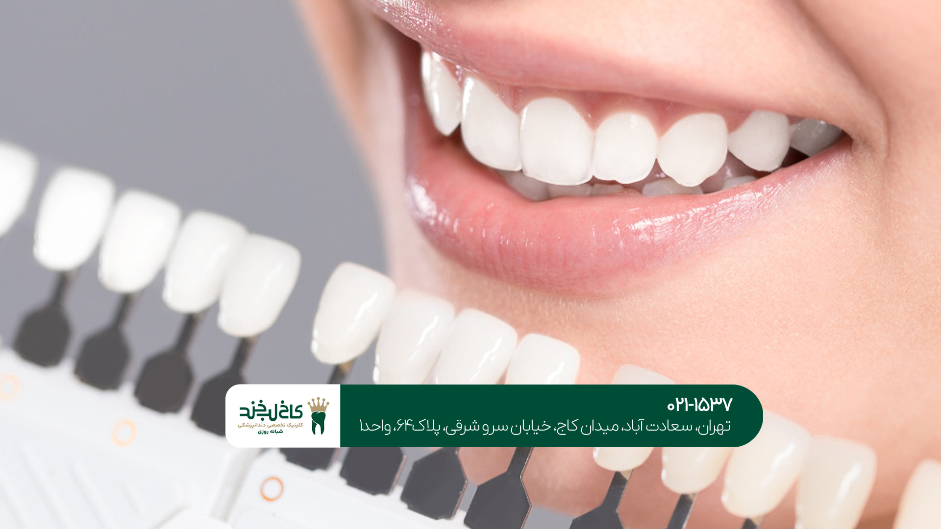 عمل های تخصصی زیبایی دندان عمل های تخصصی زیبایی دندان