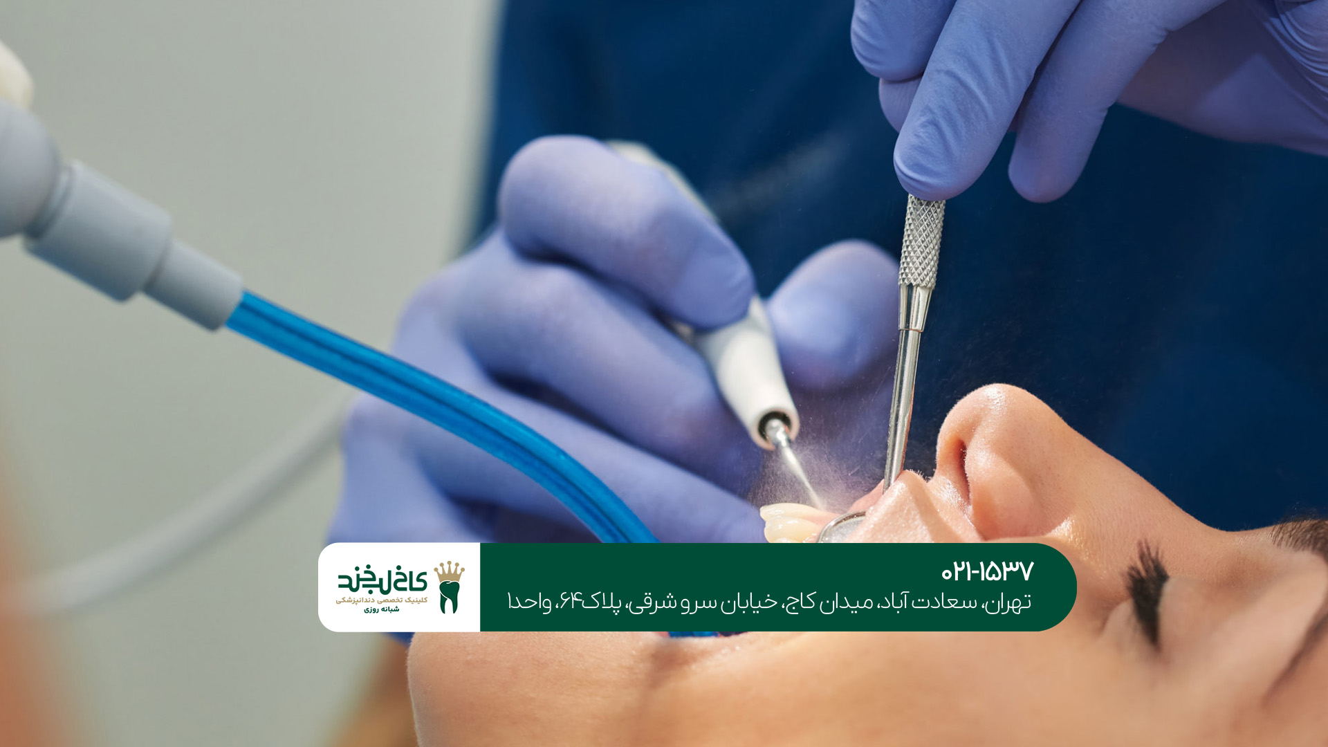 بهترین عمل زیبایی دندان