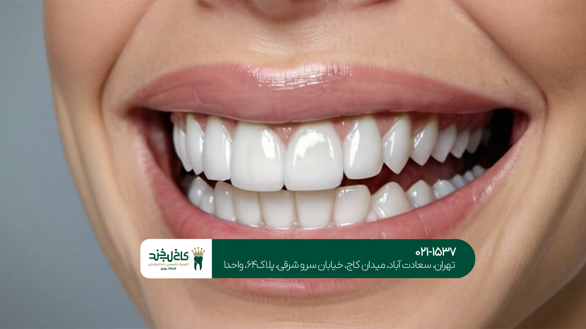 مرکز تخصصی زیبایی دندان تهران