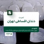 لمینت دندان اقساطی تهران