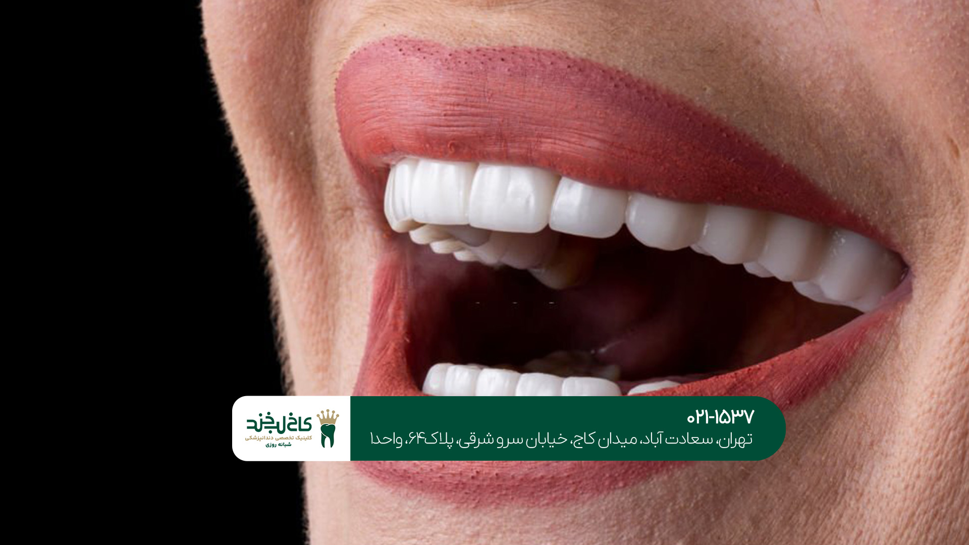 لمینت و کامپوزیت تهران لمینت و کامپوزیت تهران