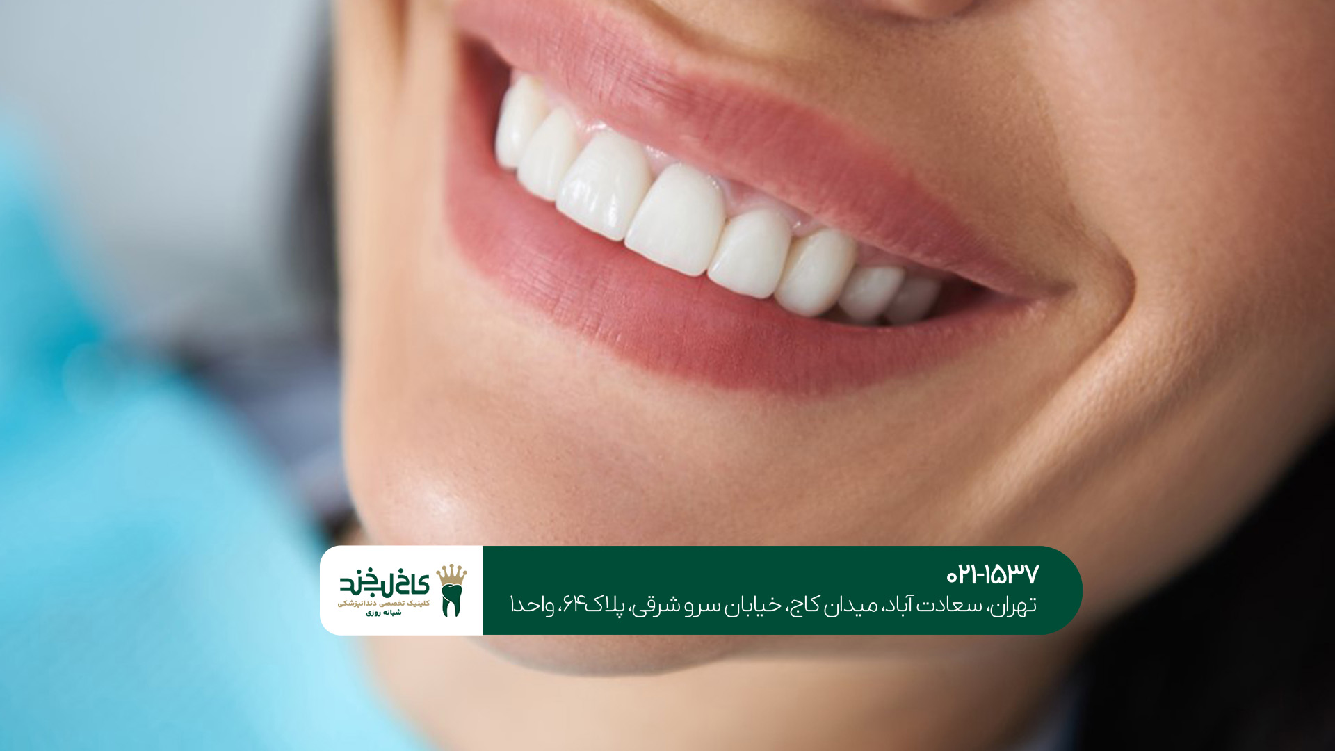 لمینت و کامپوزیت تهران لمینت و کامپوزیت تهران