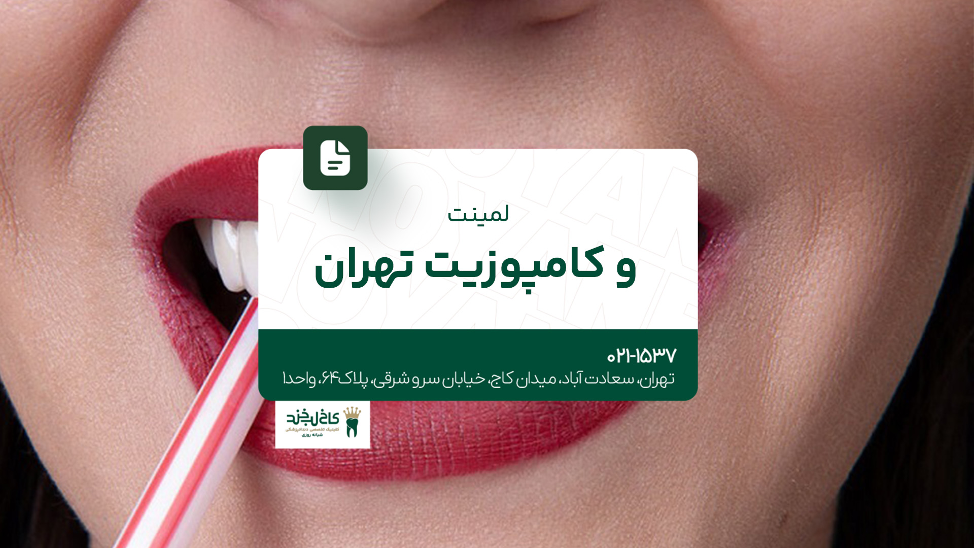 لمینت و کامپوزیت تهران لمینت و کامپوزیت تهران