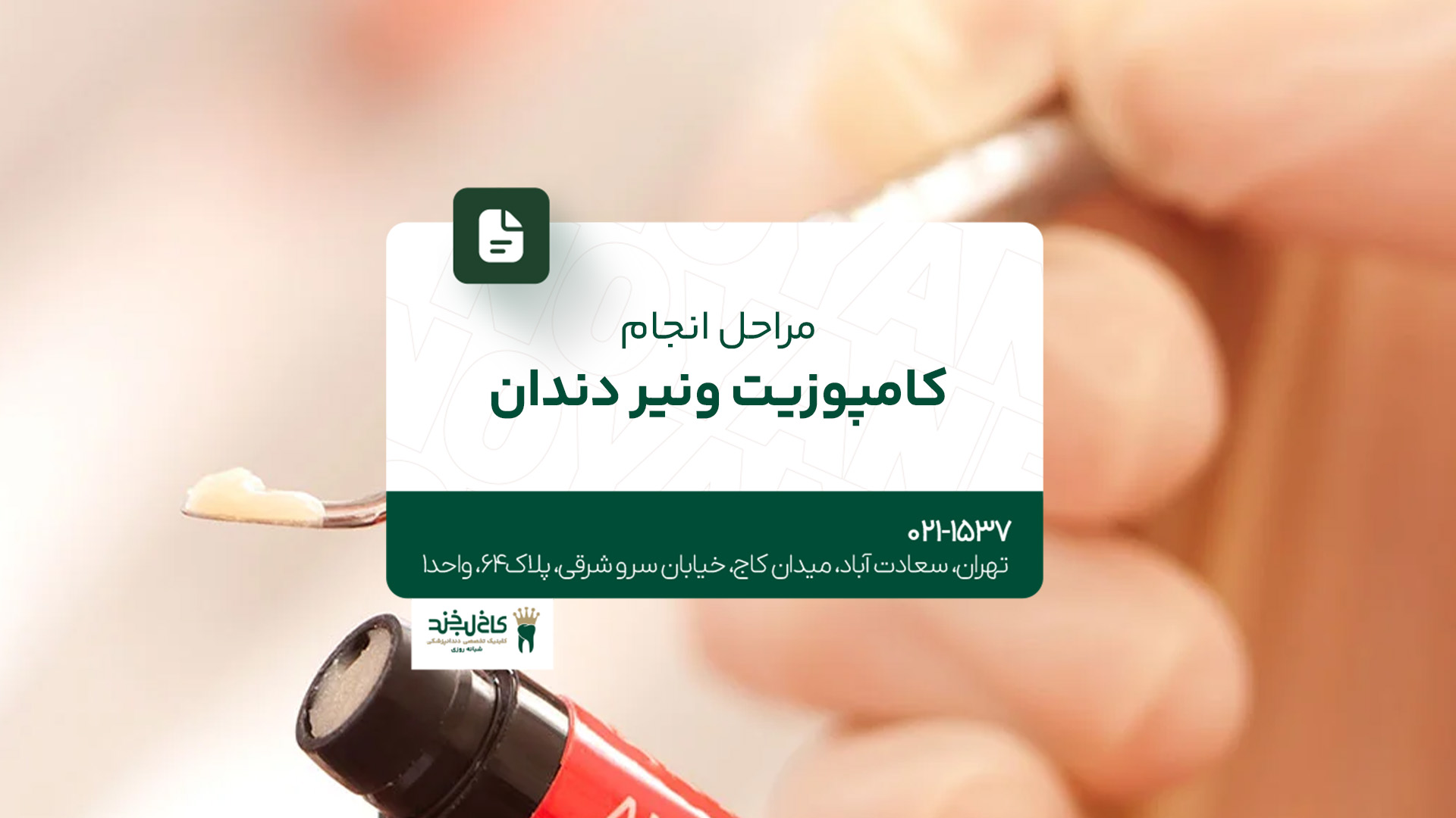 مراحل انجام کامپوزیت ونیر دندان مراحل انجام کامپوزیت ونیر دندان