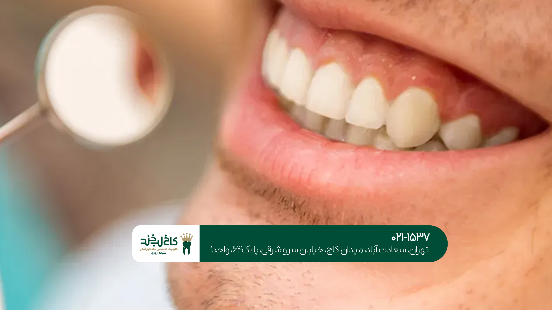 مرکز تخصصی درمان دندان تهران مرکز تخصصی درمان دندان تهران