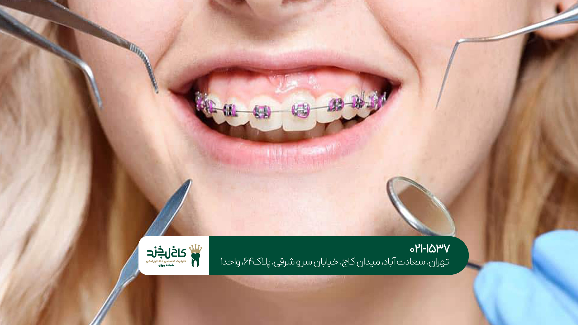 مرکز ارتودنسی بزرگسالان و کودکان